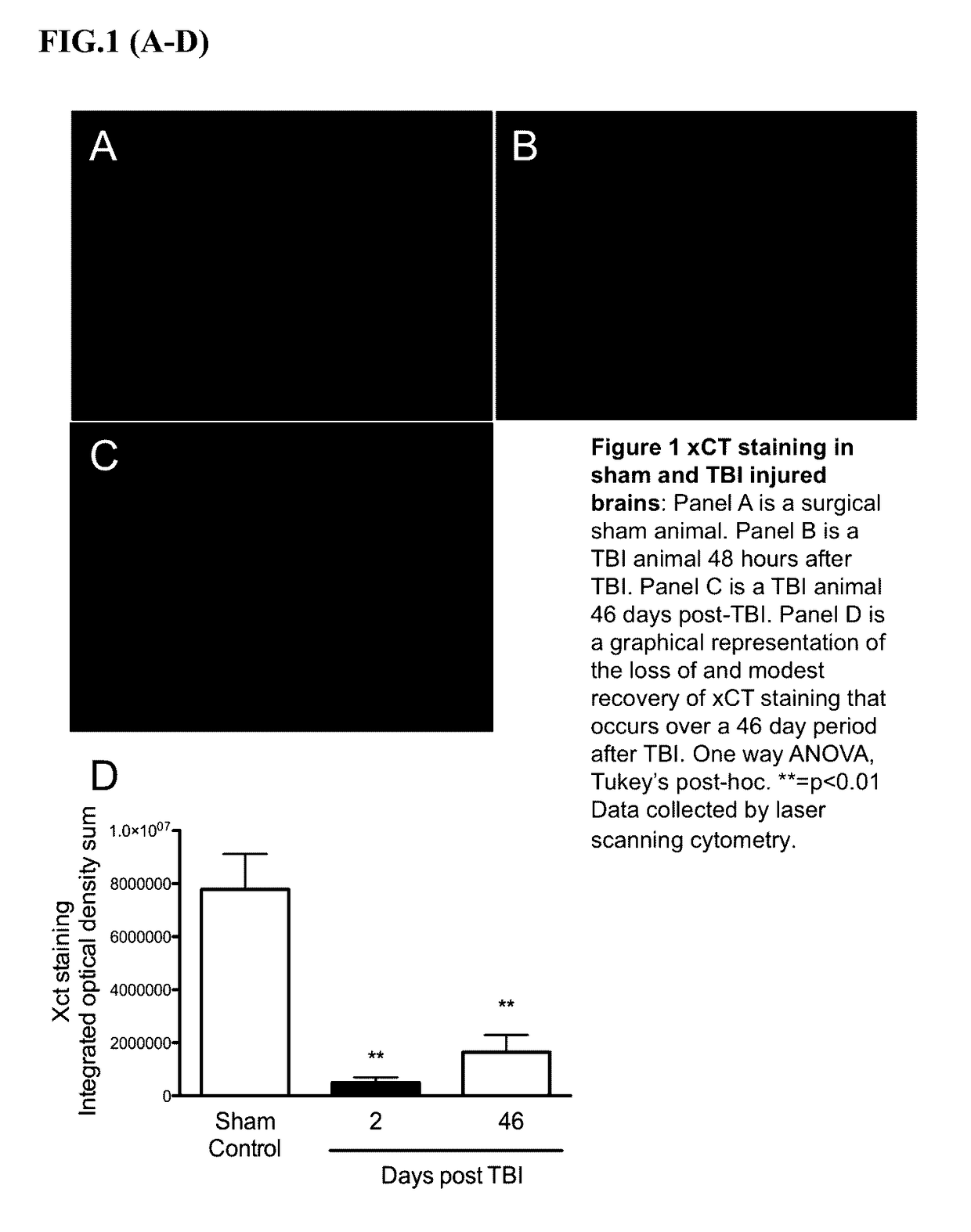 Detection of traumatic brain injury