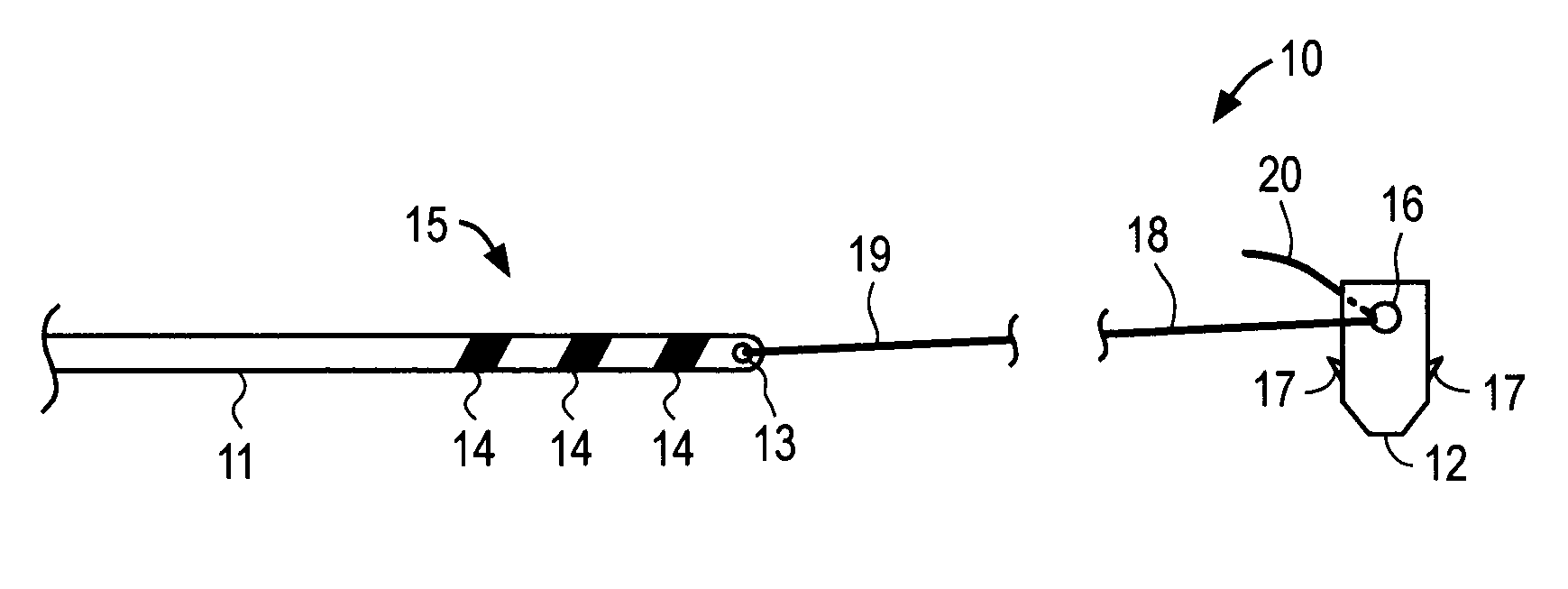 Apparatus and methods for anchoring electrode leads for use with implantable neuromuscular electrical stimulator