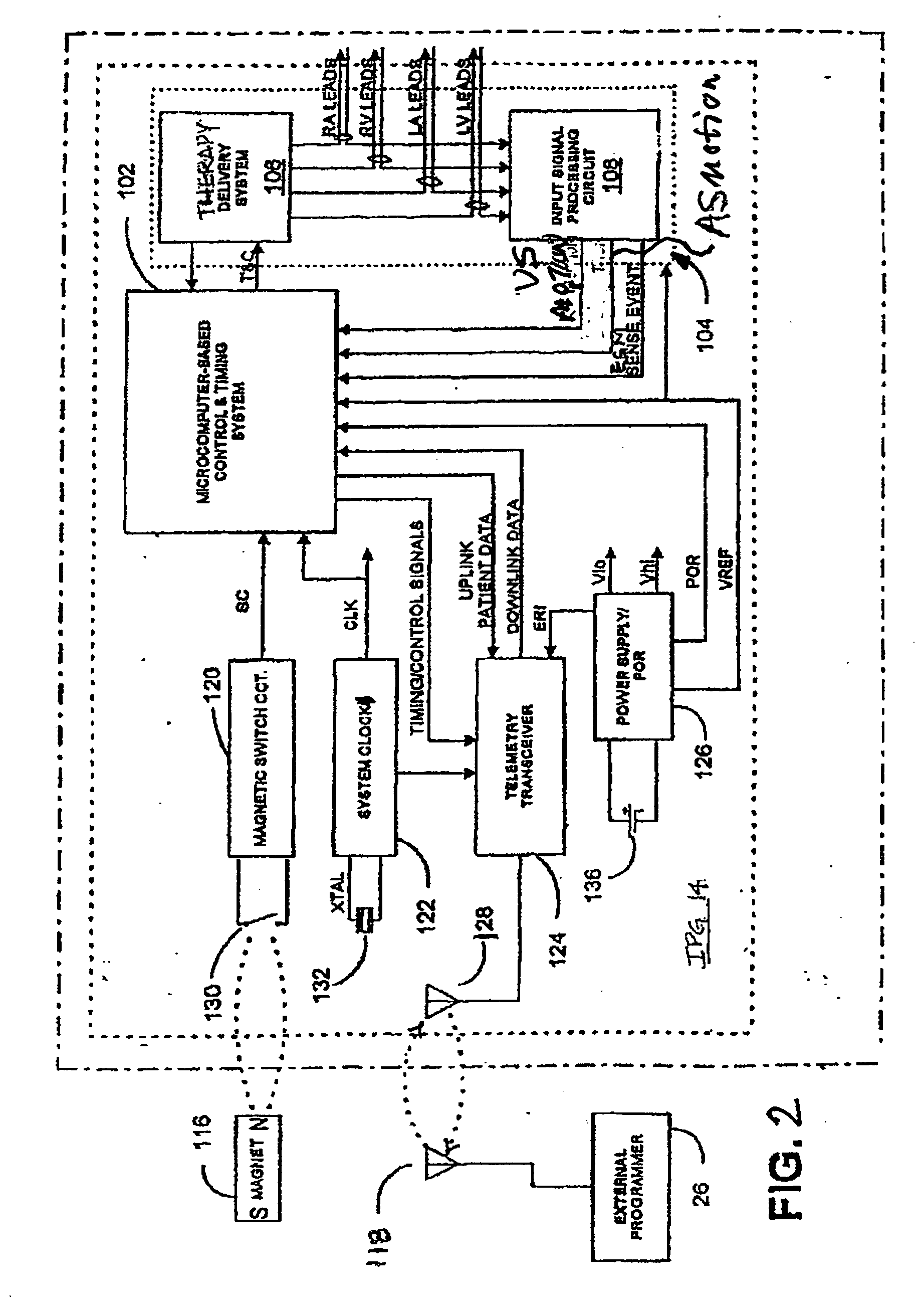 Method of optimizing cardiac resynchronization therapy using sensor signals of septal wall motion