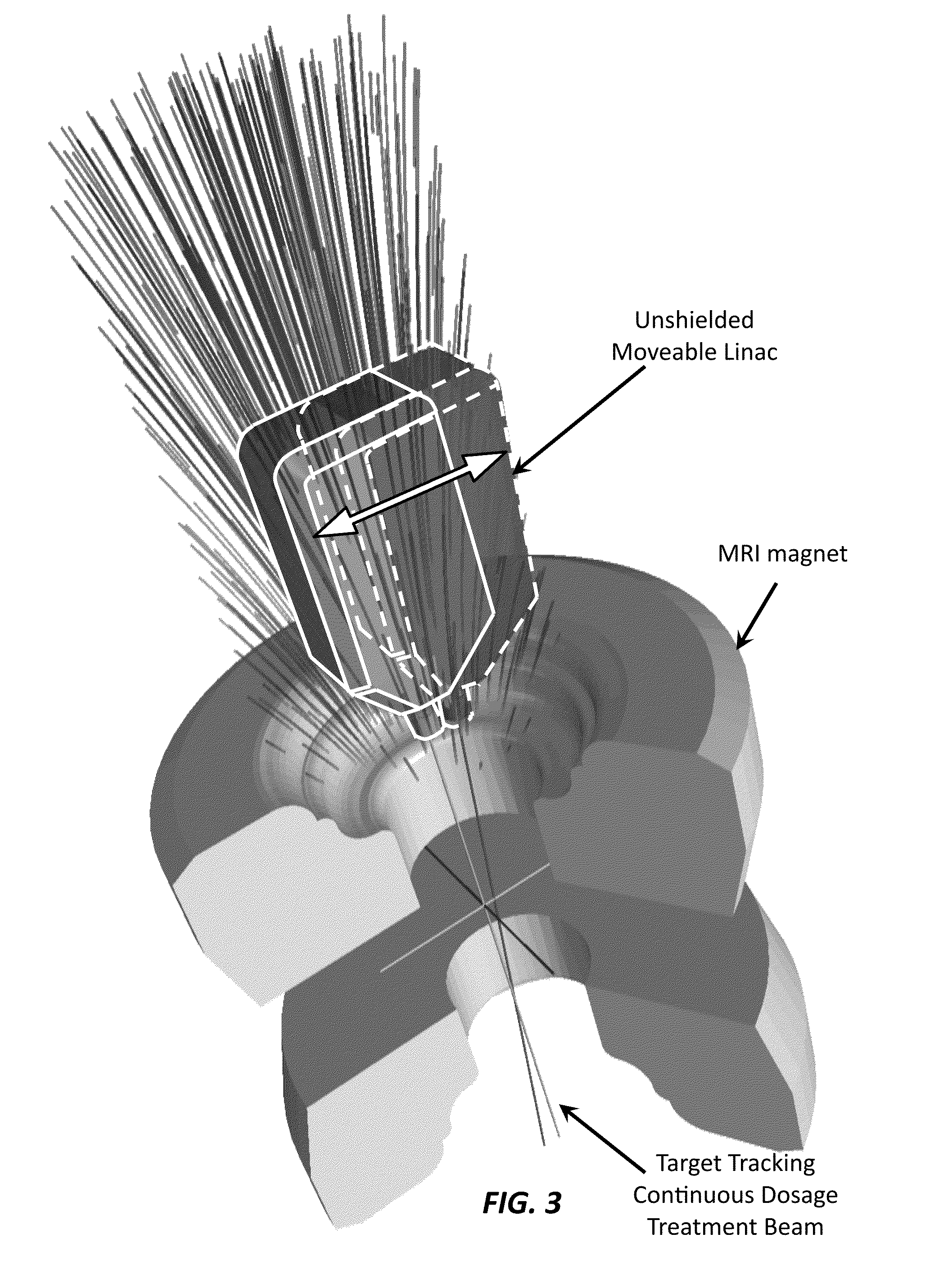 Robotic Linac Adaptation (RLA) for the in-line MRI-linac Configuration