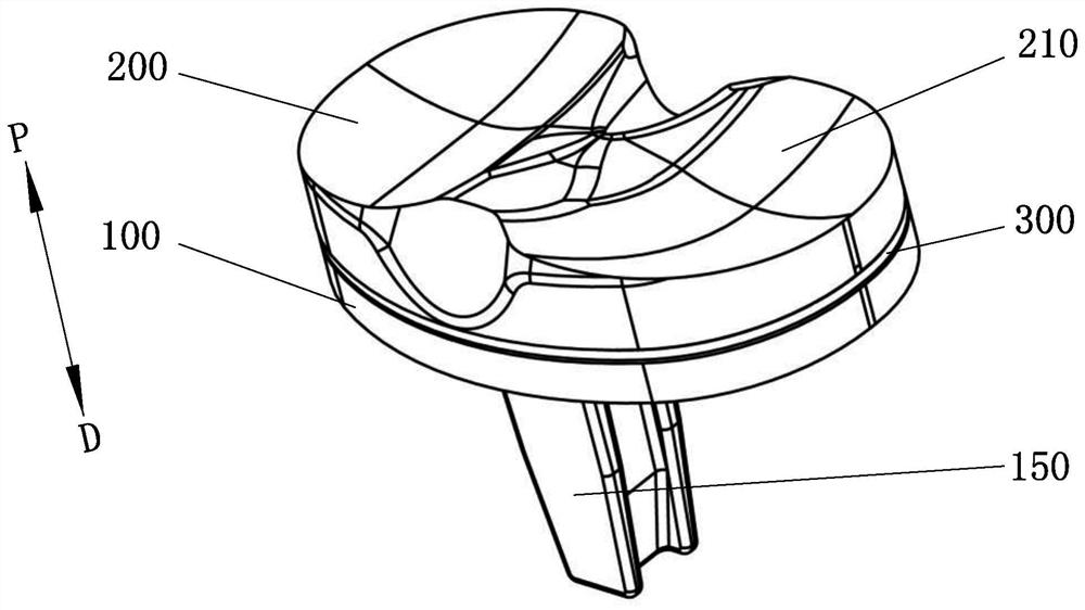 Tibial prosthesis and knee joint prosthesis comprising same