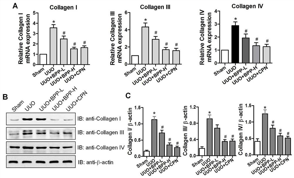 Application of Balanophora extract in preparation of anti-renal fibrosis drug