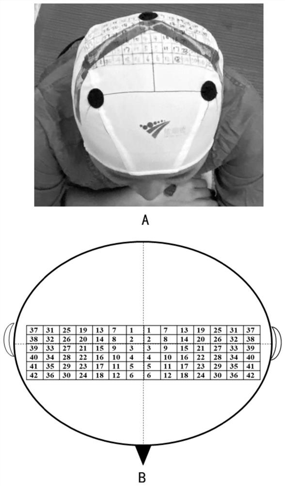 A method for assessing the motor representation area of ​​the cerebral cortex of the trunk muscles and its application