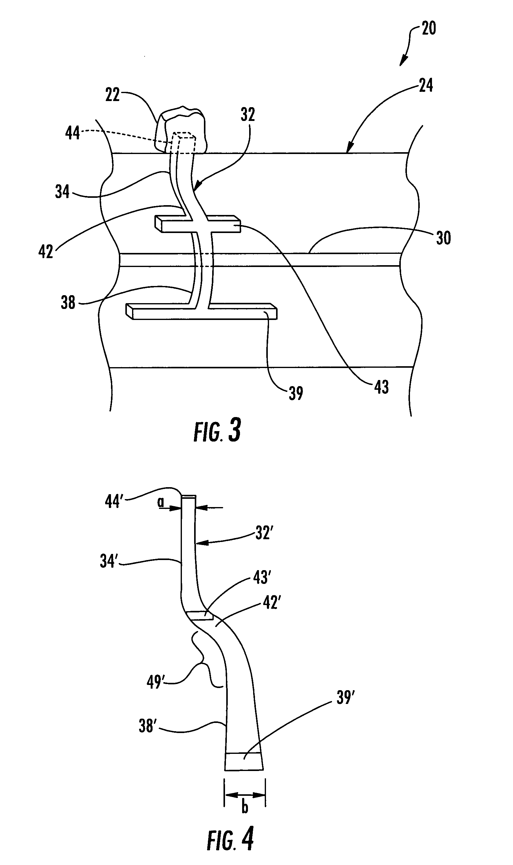 Dental fixture implantation system and associated method