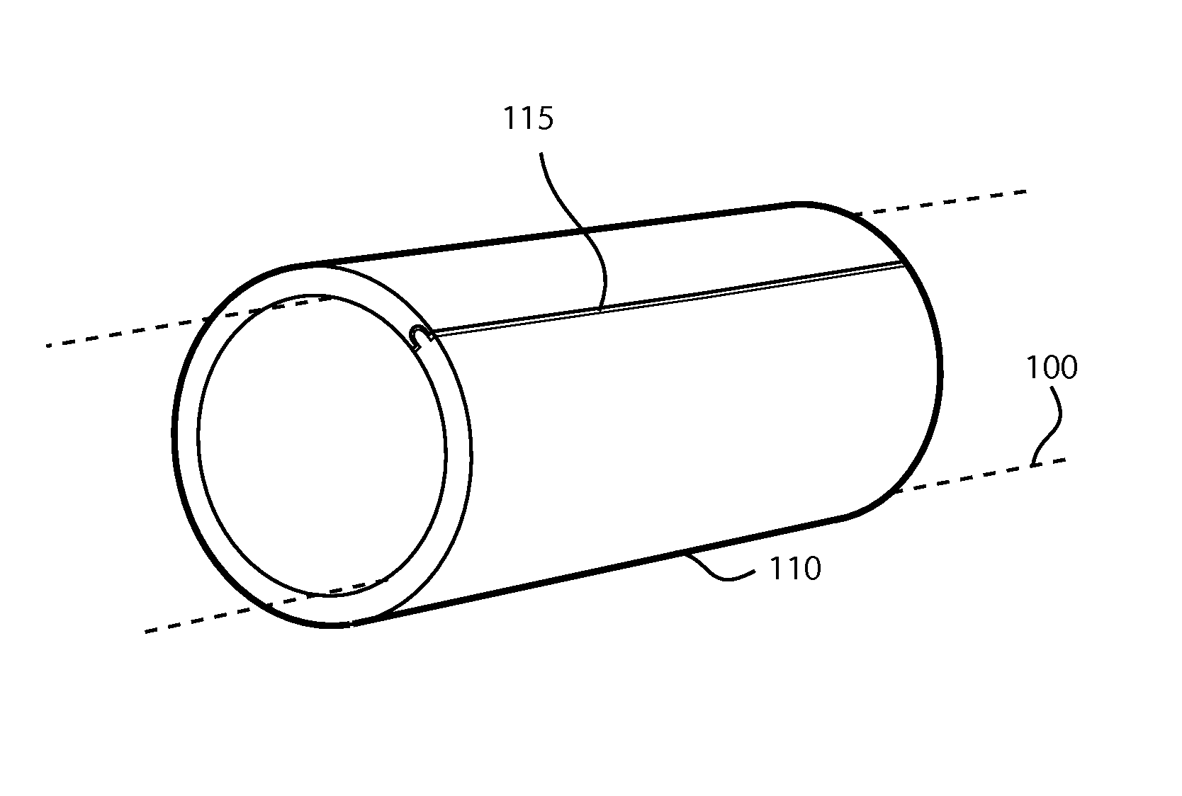 Method for deploying a sleeve and tubing device for restricting and constricting aneurysms and a sleeve and tubing device and system