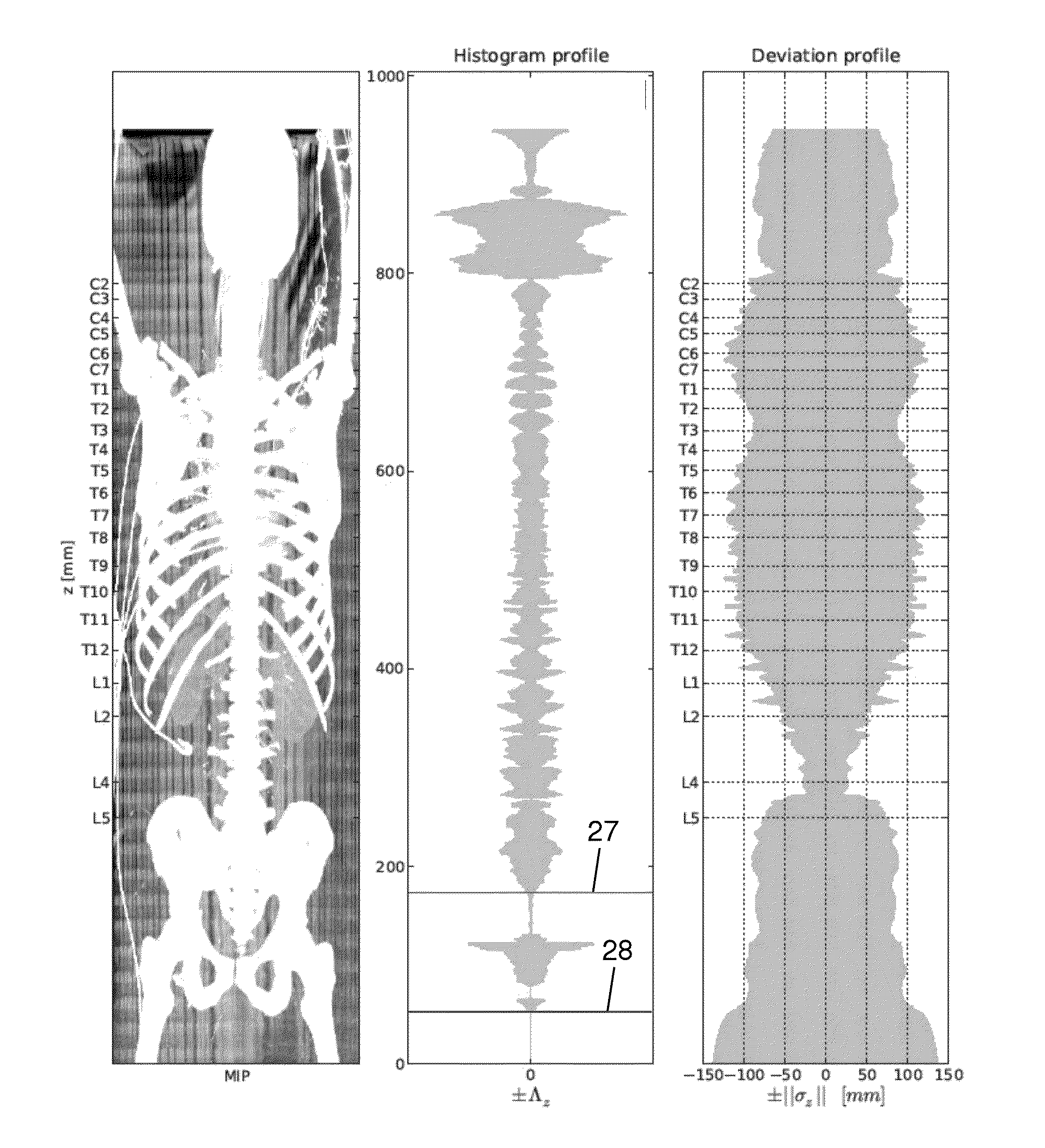 Method, apparatus and system for localizing a spine