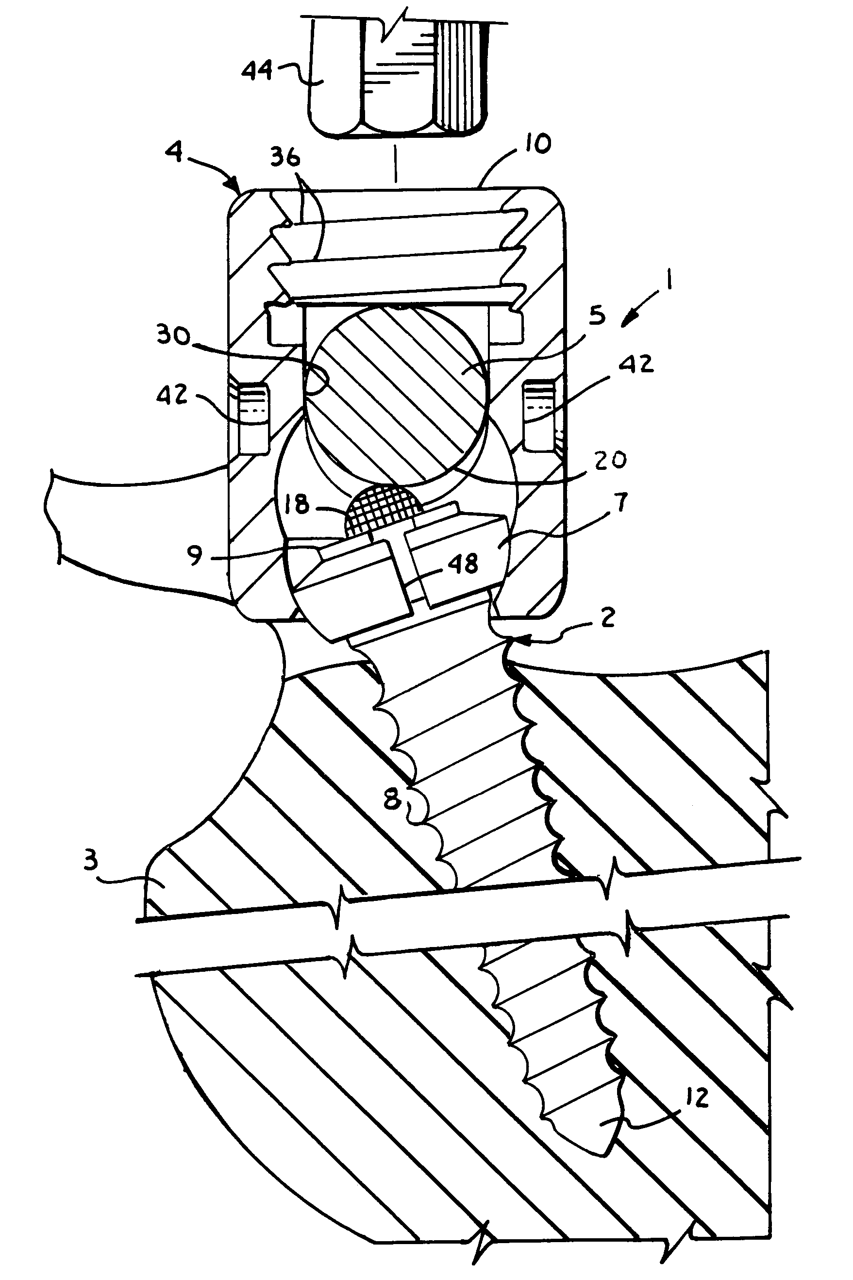 Polyaxial bone screw with split retainer ring