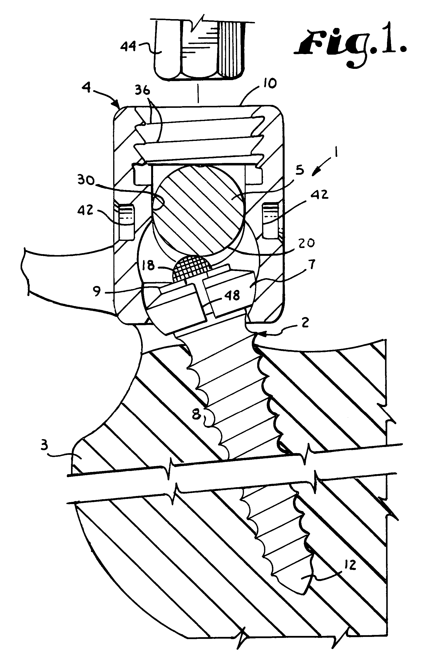 Polyaxial bone screw with split retainer ring