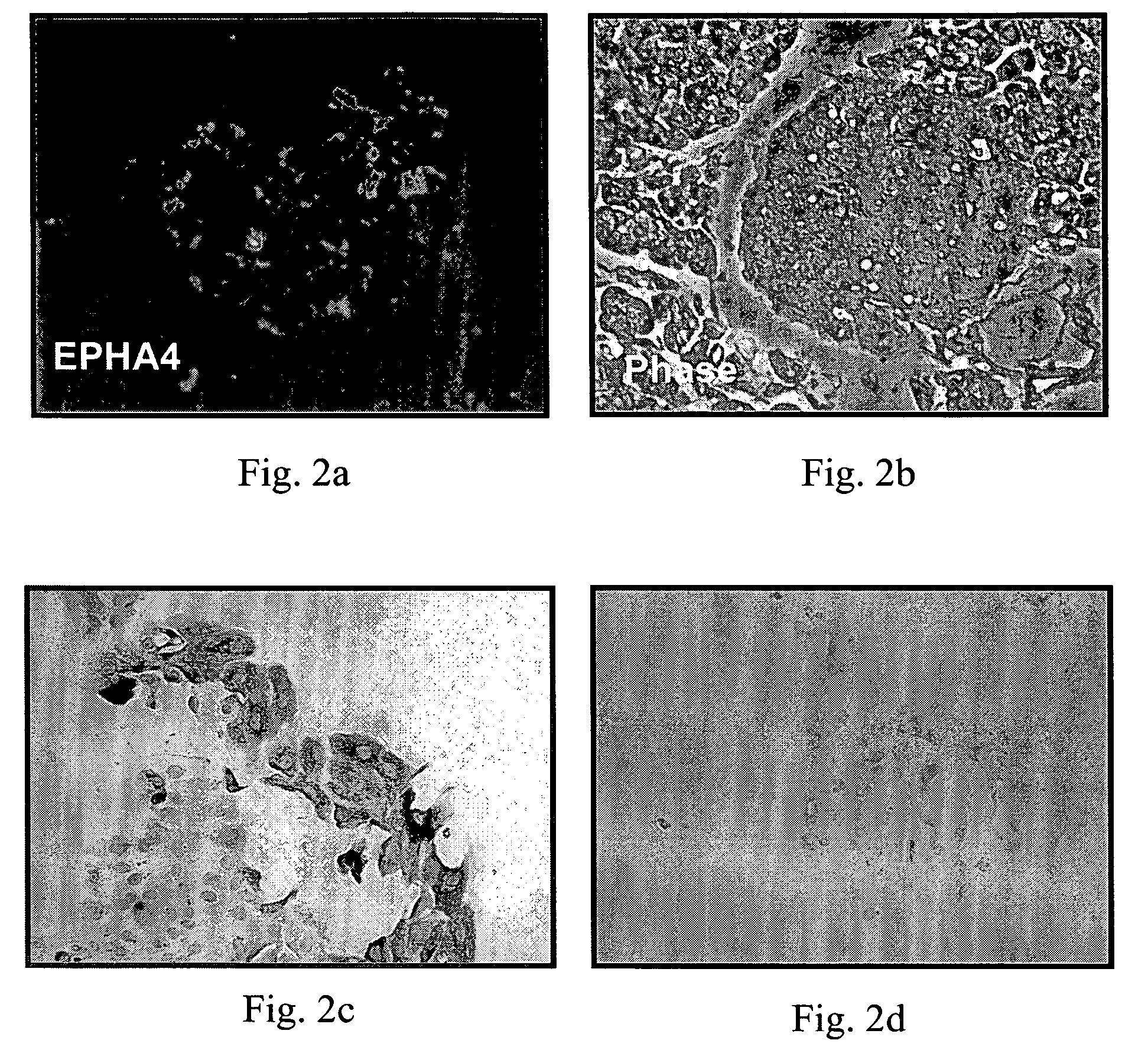 EphA4-positive human adult pancreatic endocrine progenitor cells