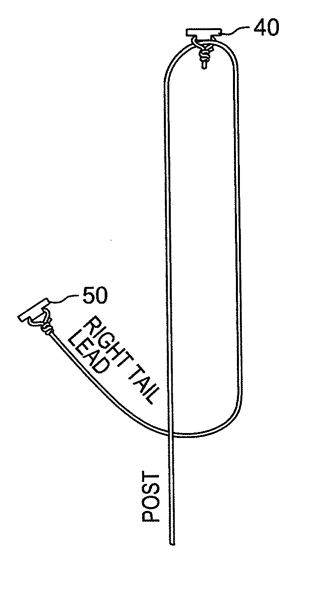 Method and system for meniscal repair using suture implant cinch construct