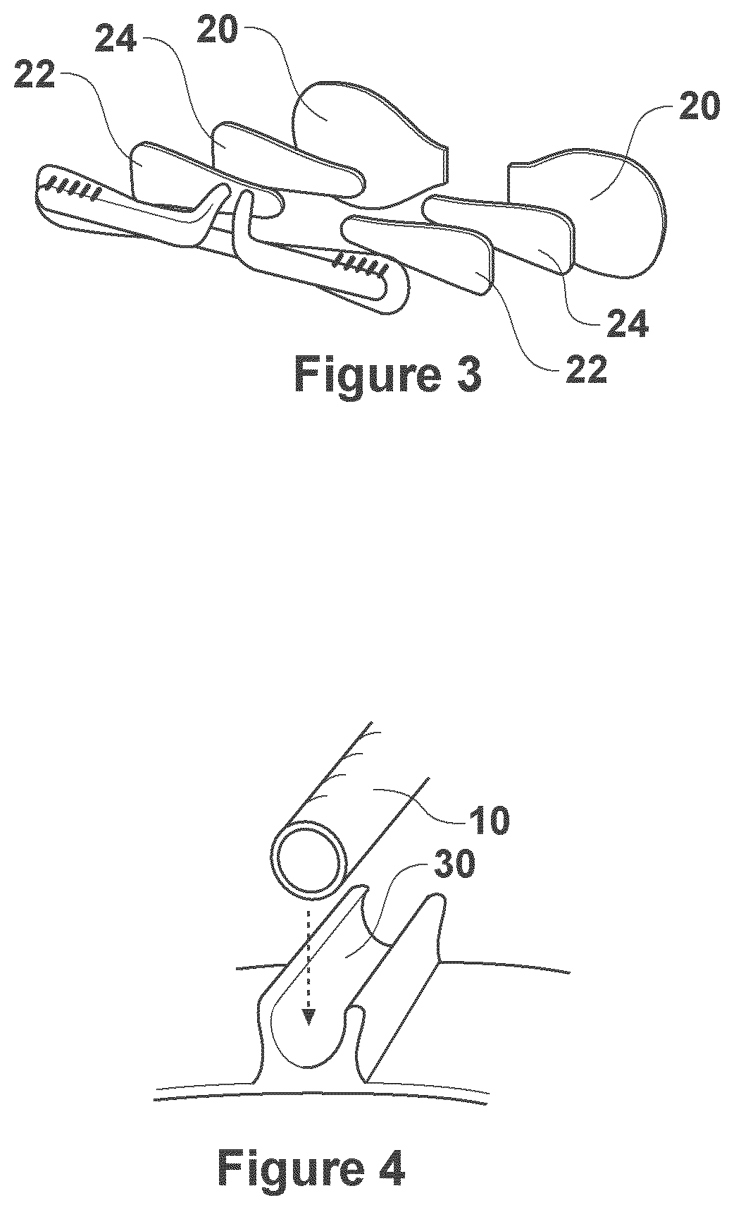 Patient tube securement apparatus for securing a patient tube to a patient