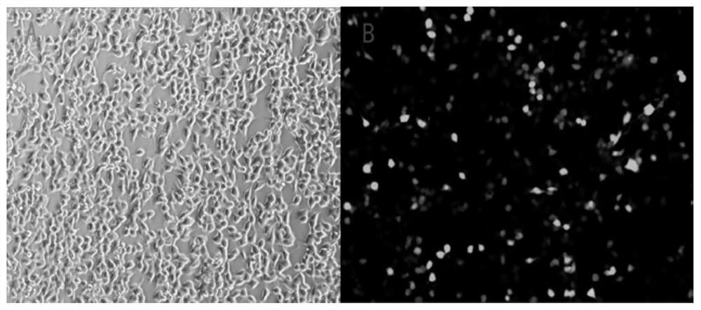 Method for differentiating peripheral blood stem cells into endoderm cells and application thereof