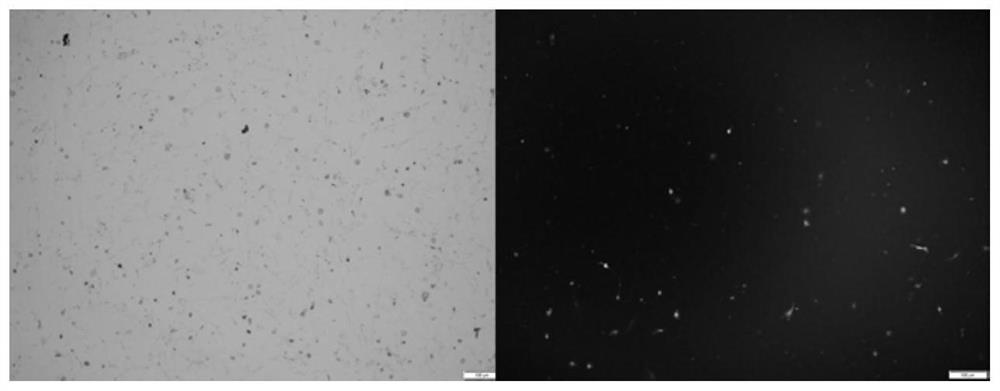 Method for differentiating peripheral blood stem cells into endoderm cells and application thereof