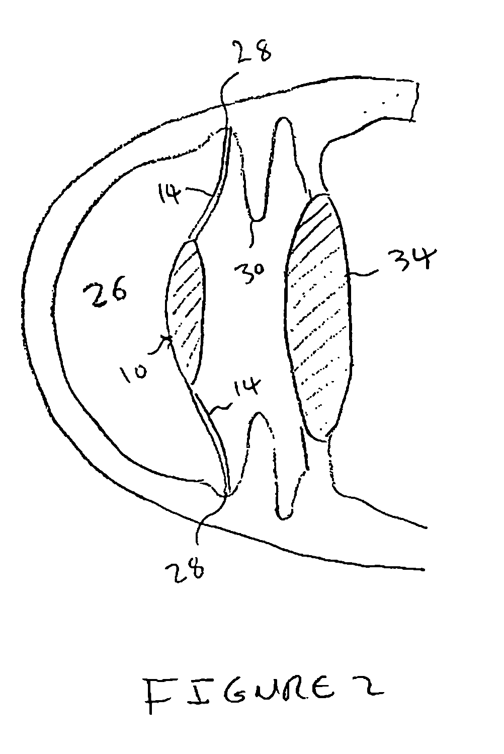 Contrast-enhancing aspheric intraocular lens