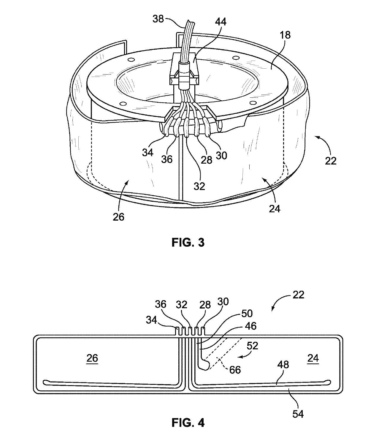 Optical Detection And Measurement Of Hematocrit And Free Hemoglobin Concentration