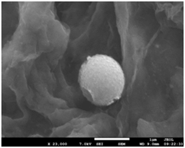 A kind of electrochemical immunosensor based on janus particle and its preparation method and application