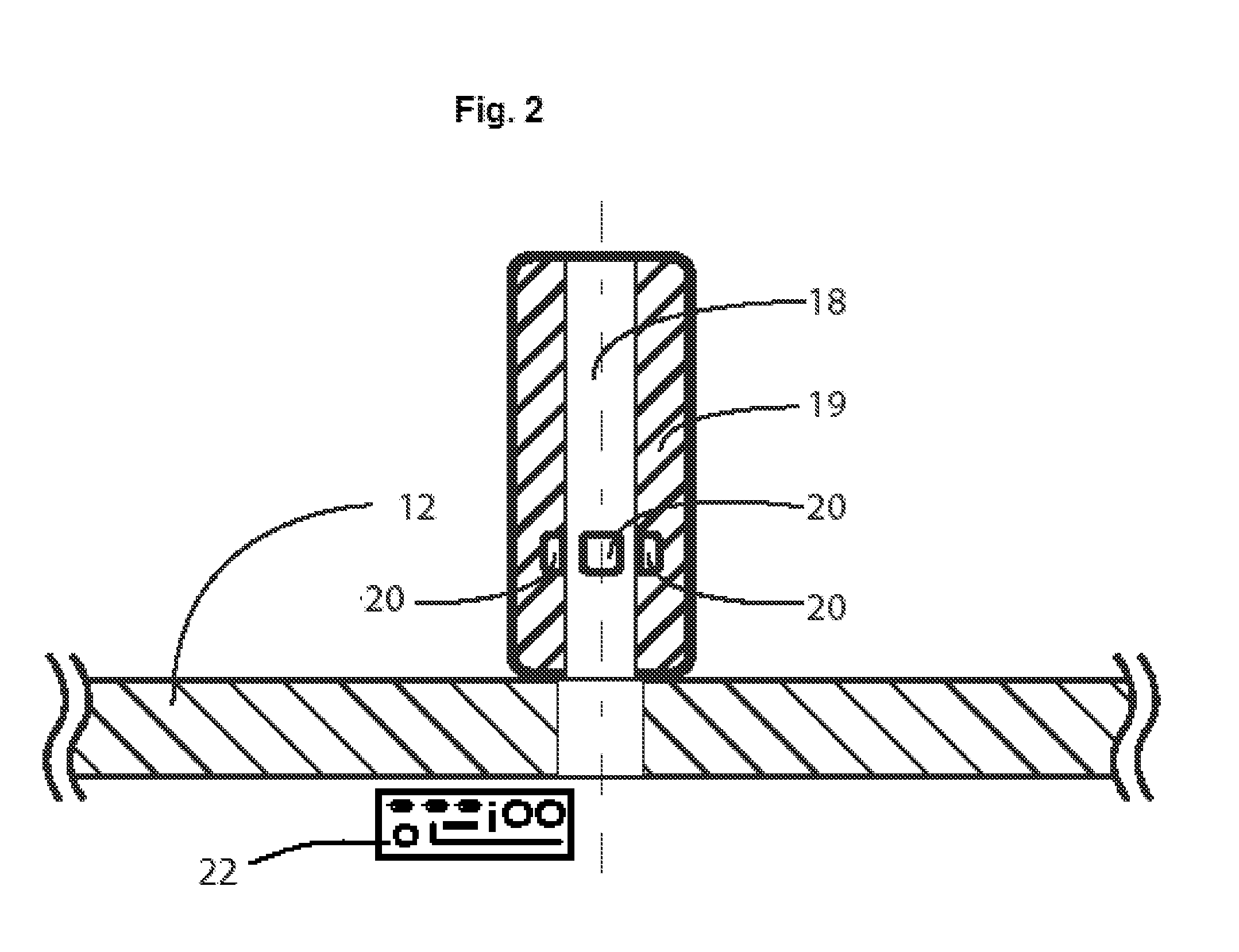 Method and Apparatus for Monitoring Surgical Traction