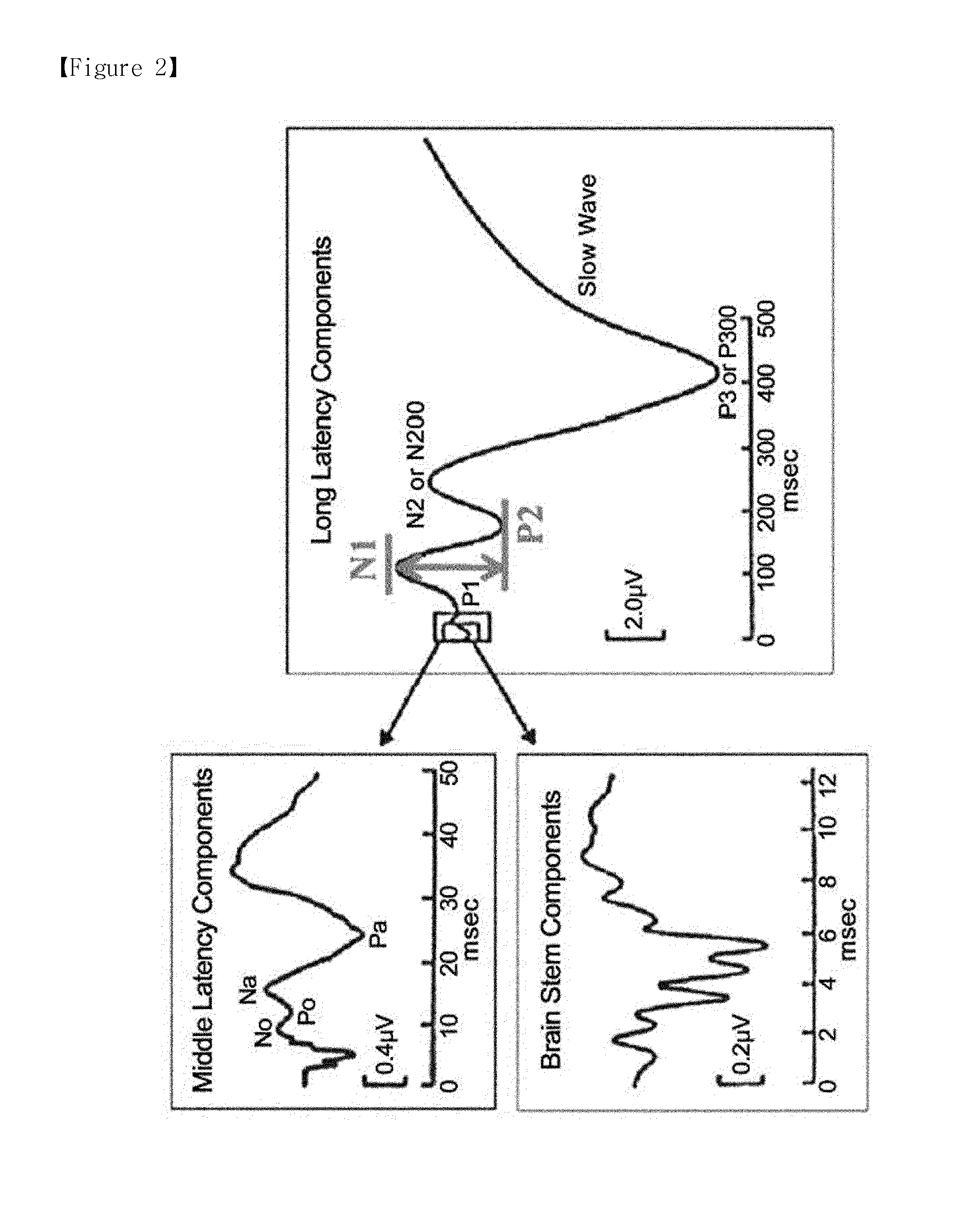 Tinnitus testing device using brain waves and tinnitus testing method using same