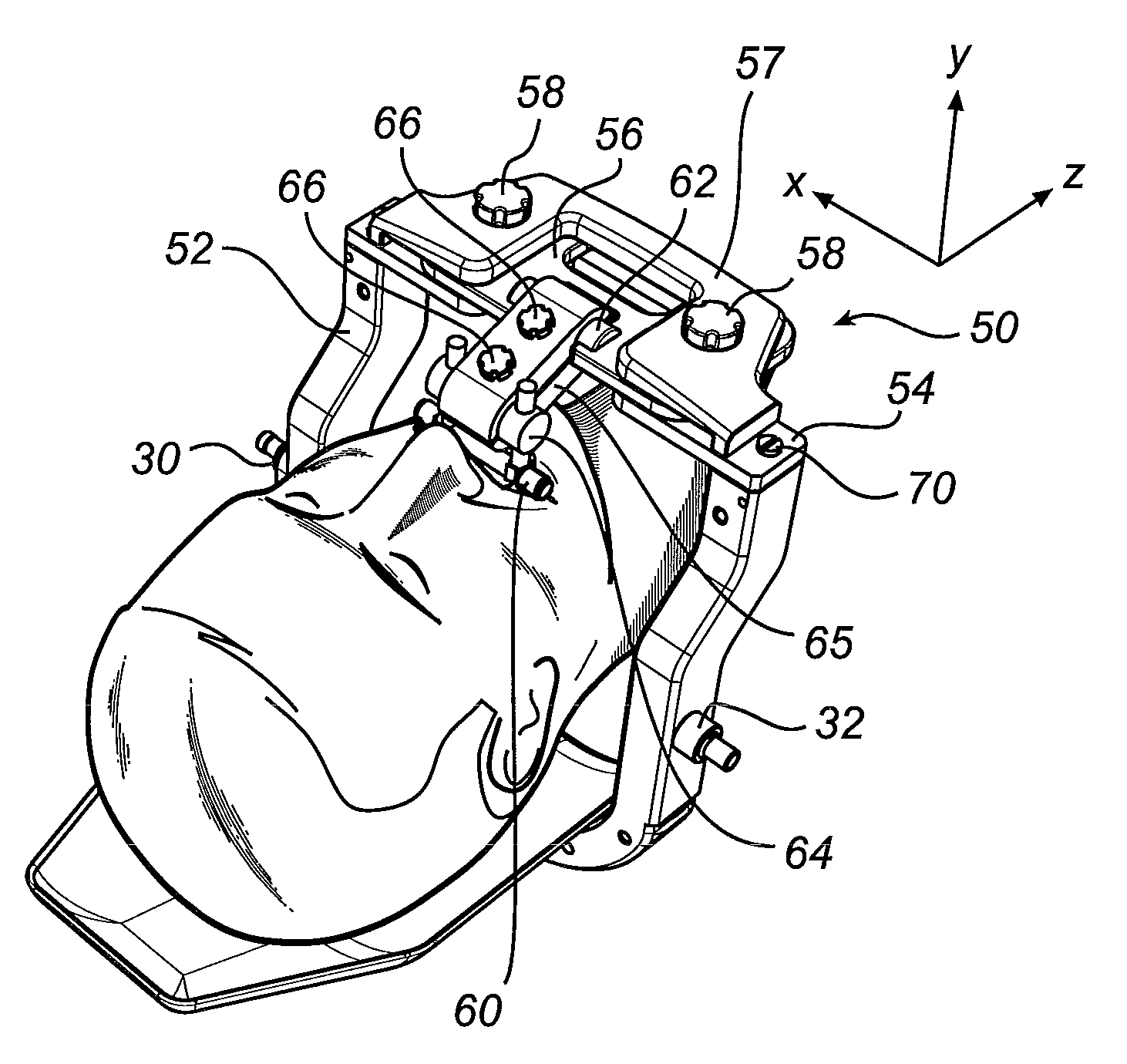 Fixation device