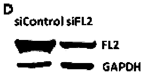 Application of FL2-siRNA in preparation of drug for treating corneal alkali burn and corneal alkali burn drug