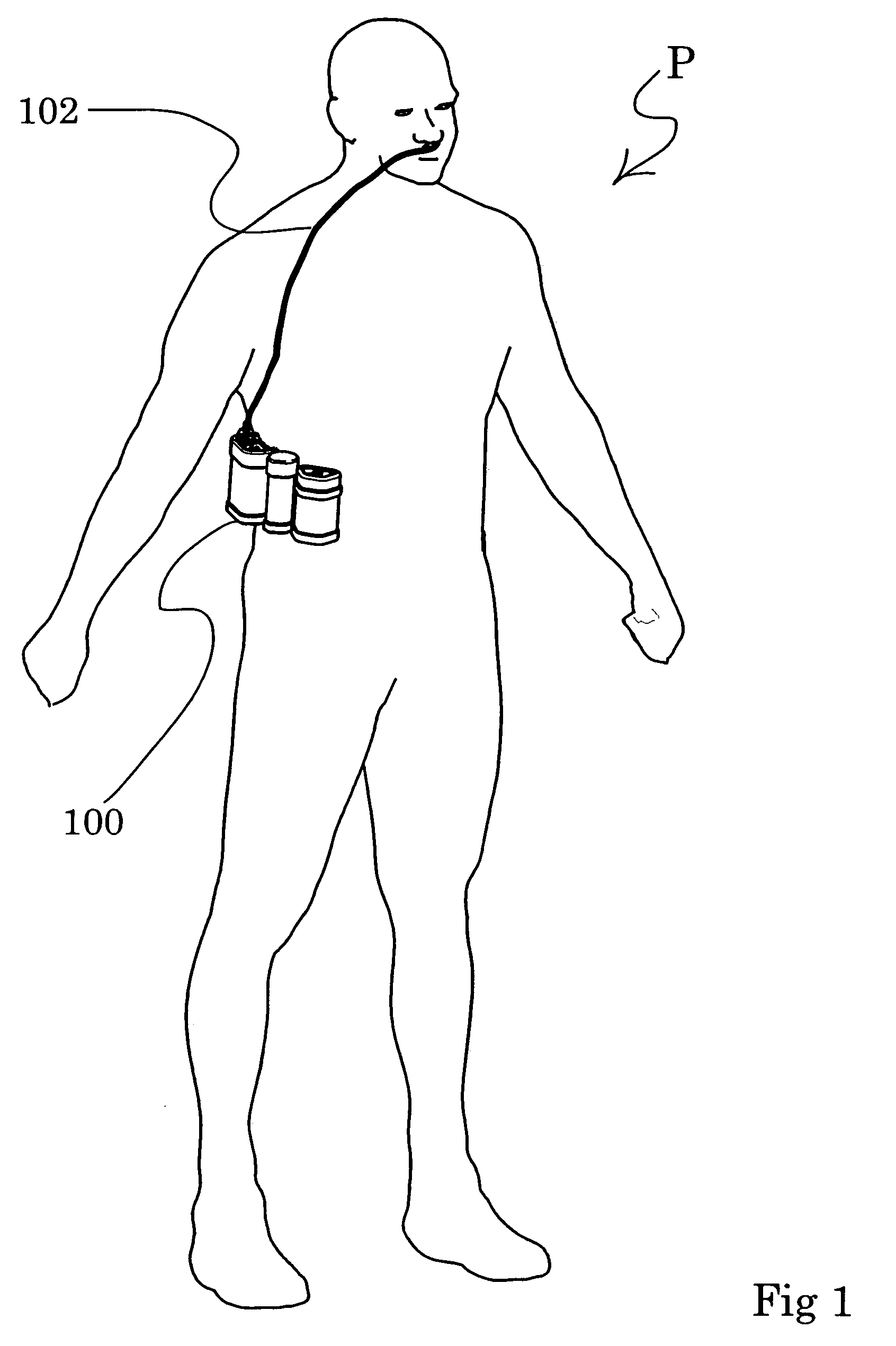 Product pump for an oxygen concentrator