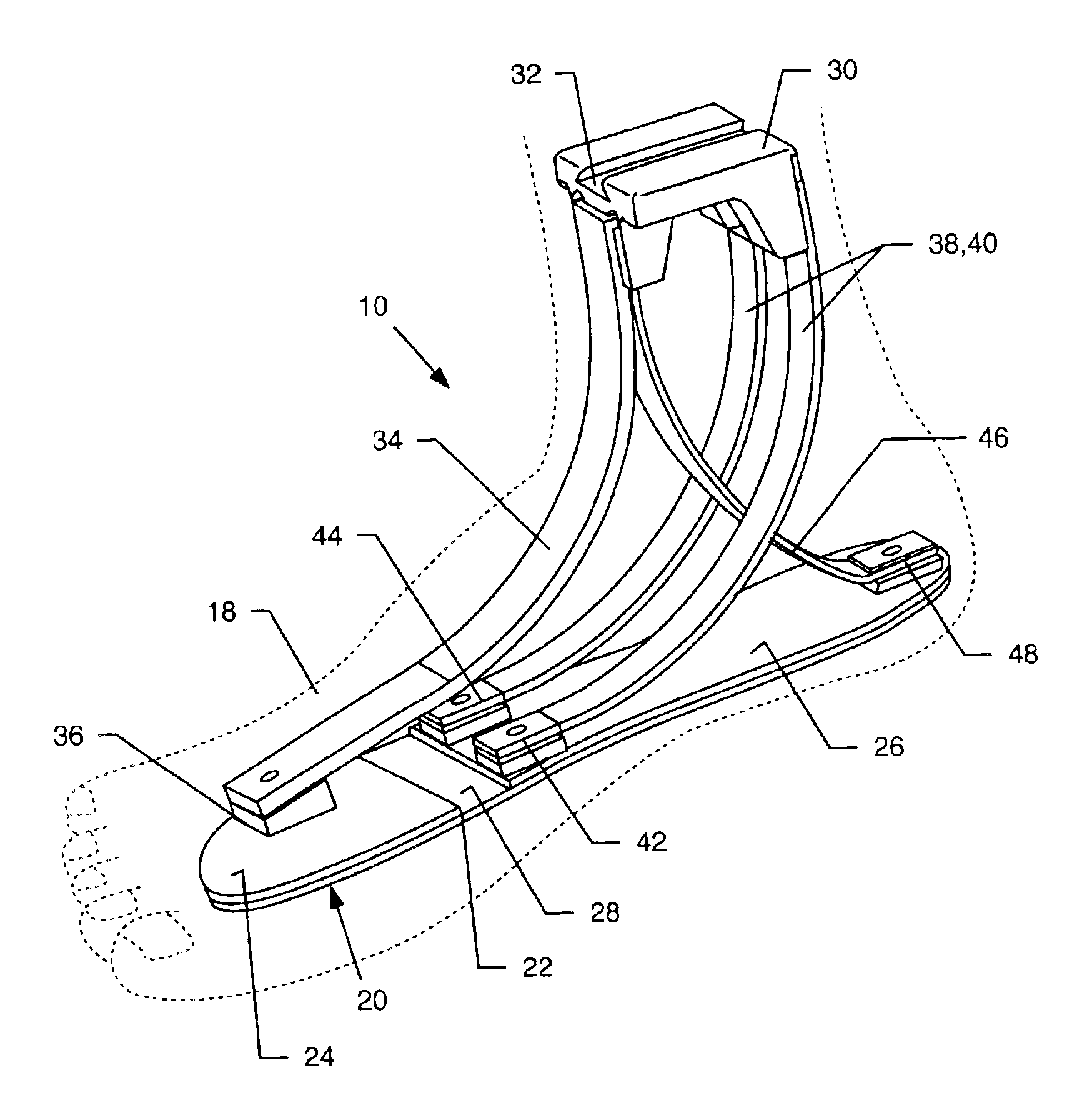 Prosthetic foot