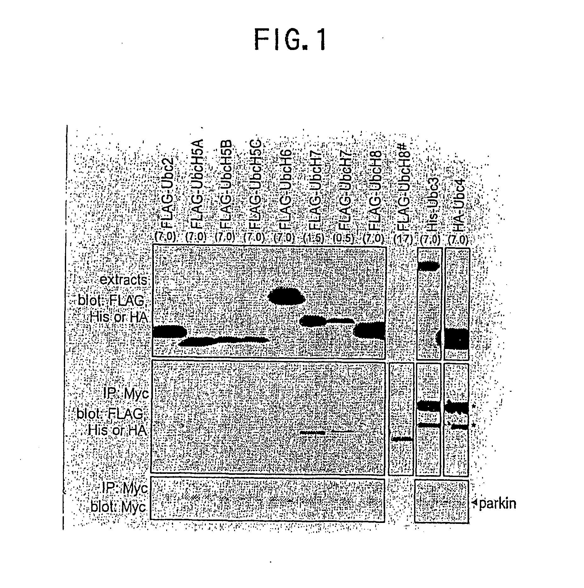 Parkin protein as ubiquitin ligase