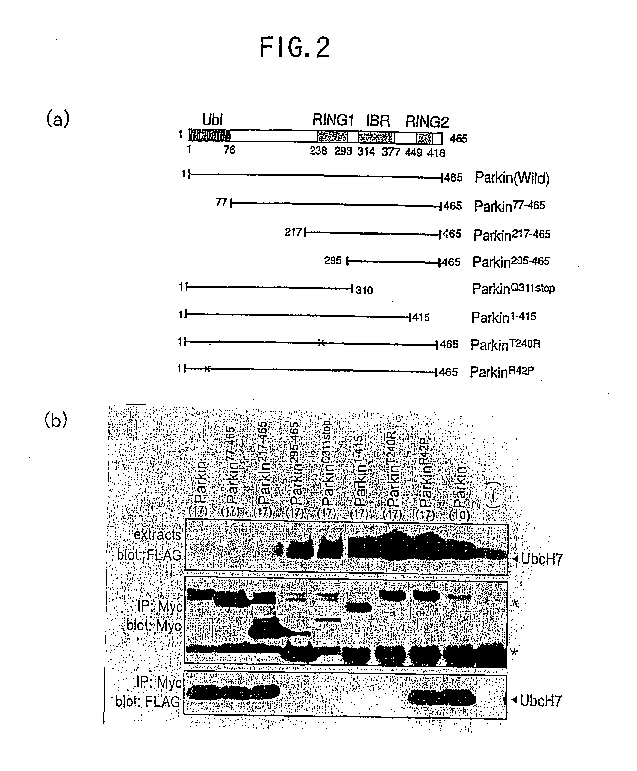 Parkin protein as ubiquitin ligase