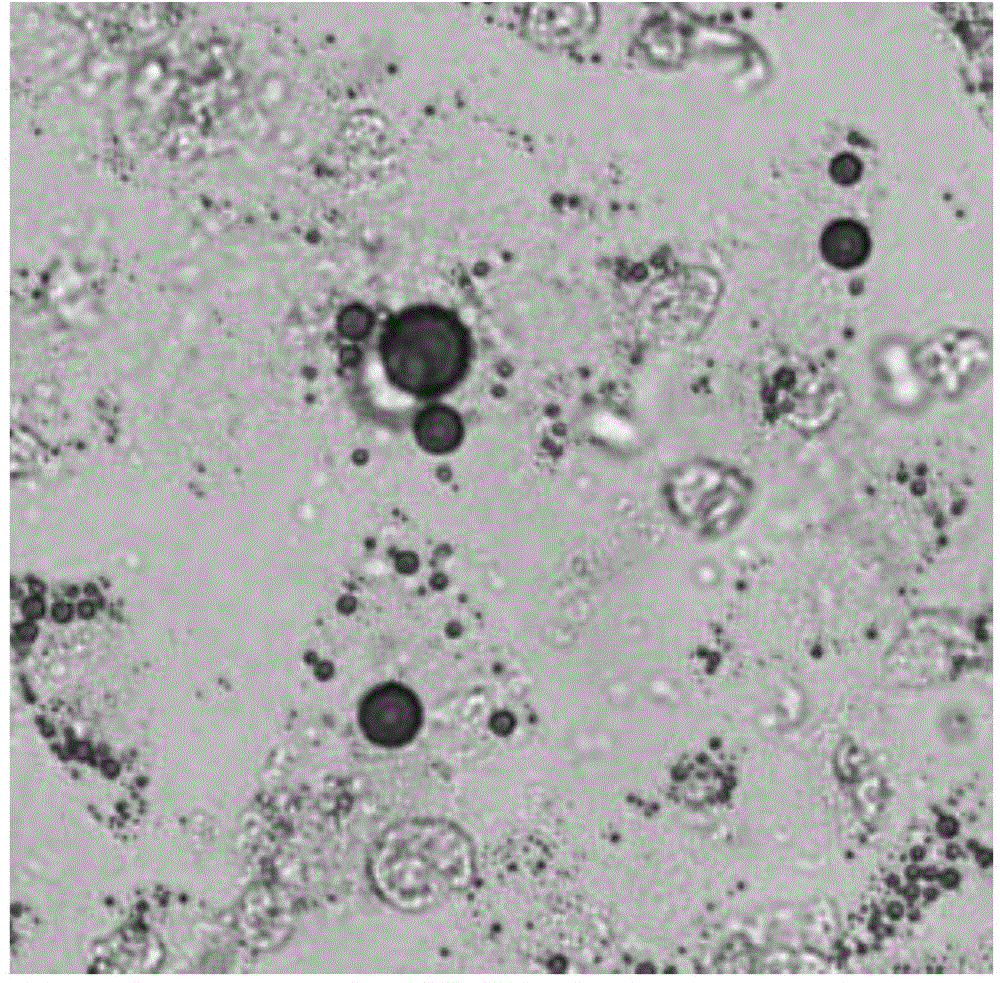 Human adipose derived mesenchymal progenitor cells for treating hepatitis B