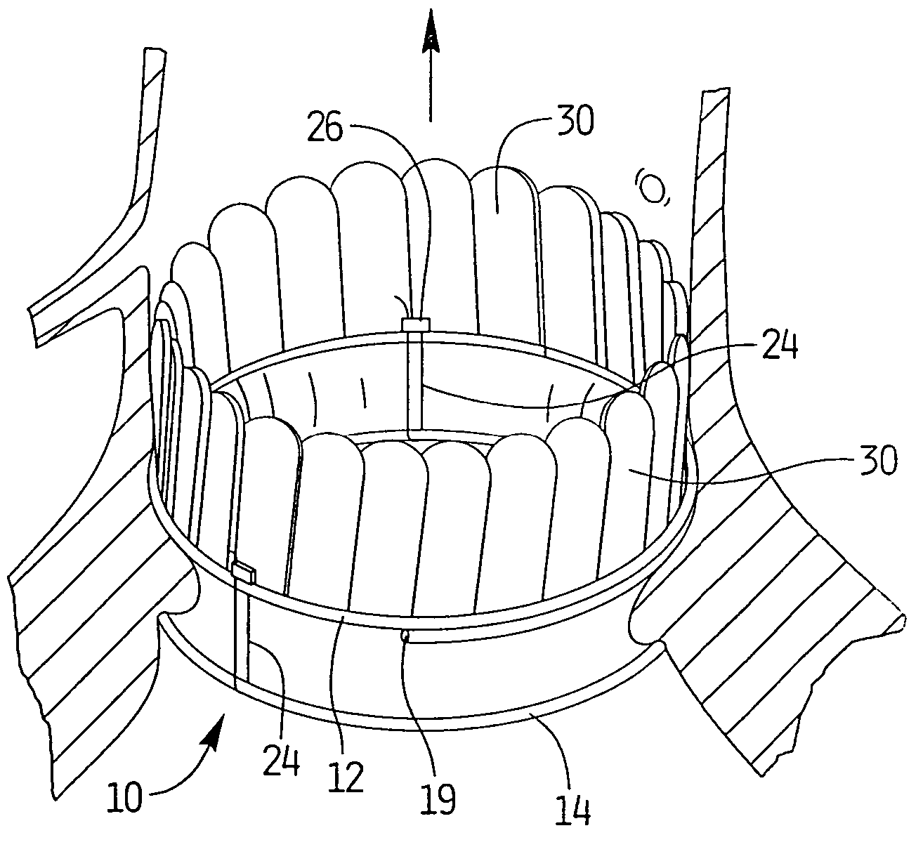 Percutaneous aortic valve