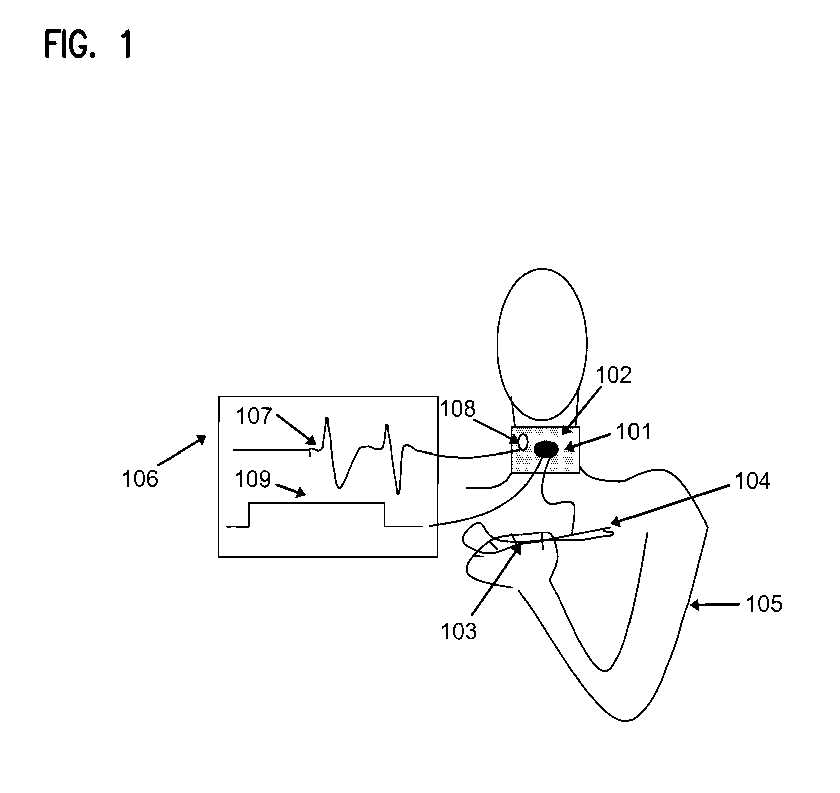 Device for volitional swallowing with a substitute sensory system