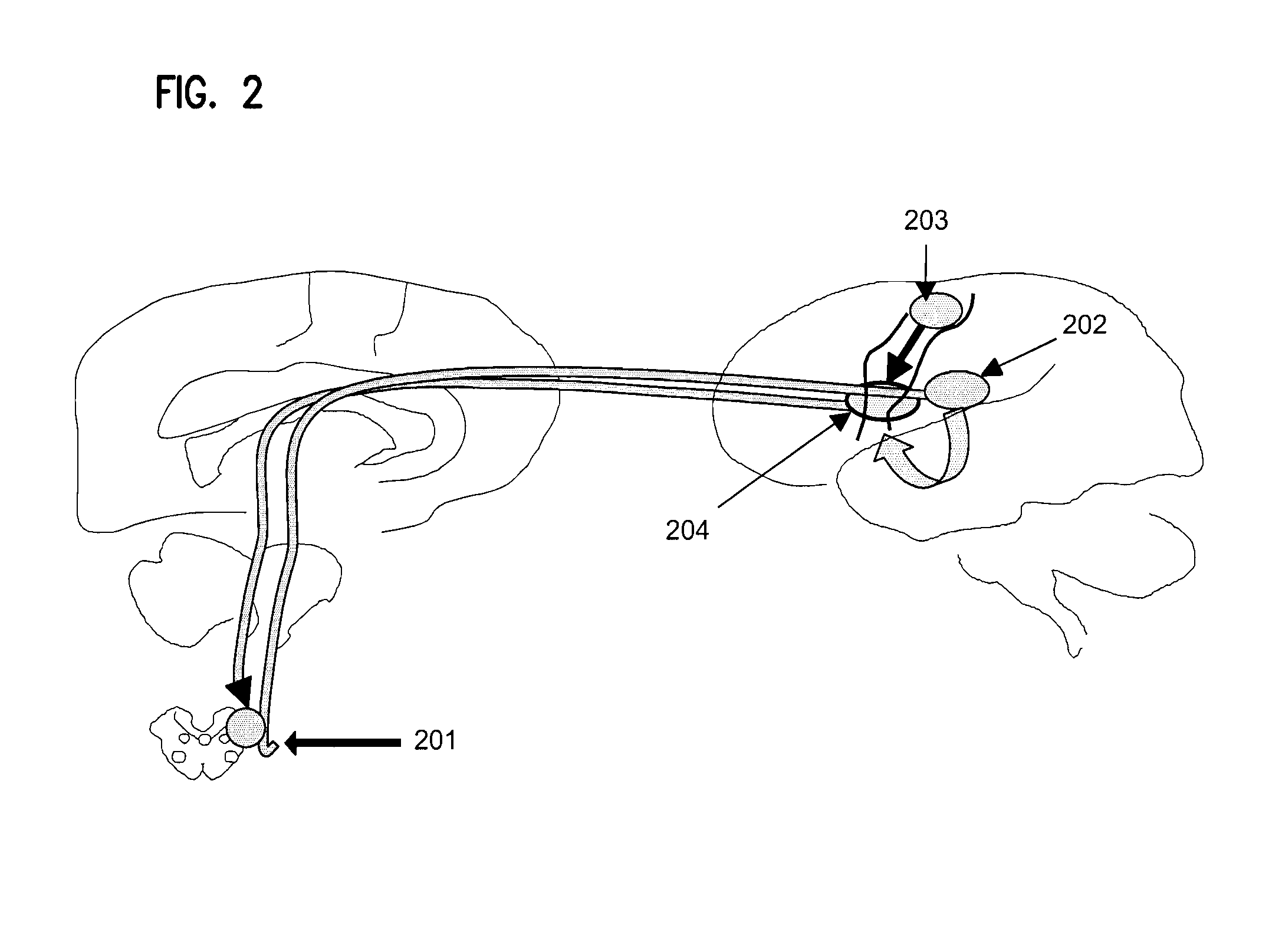 Device for volitional swallowing with a substitute sensory system