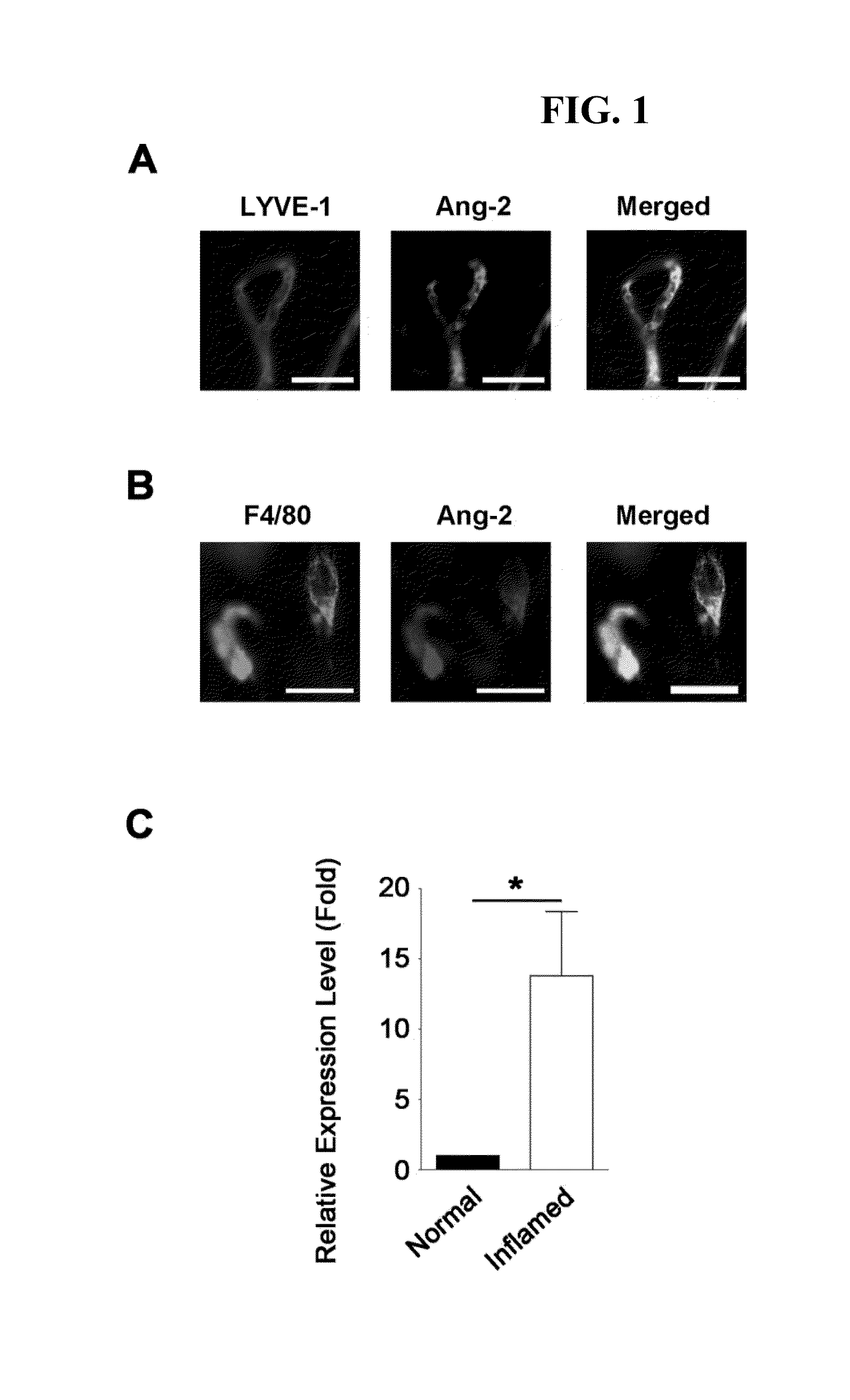 Methods of modulating lymphangiogenesis, e.g., to treat corneal transplant rejection, in a subject