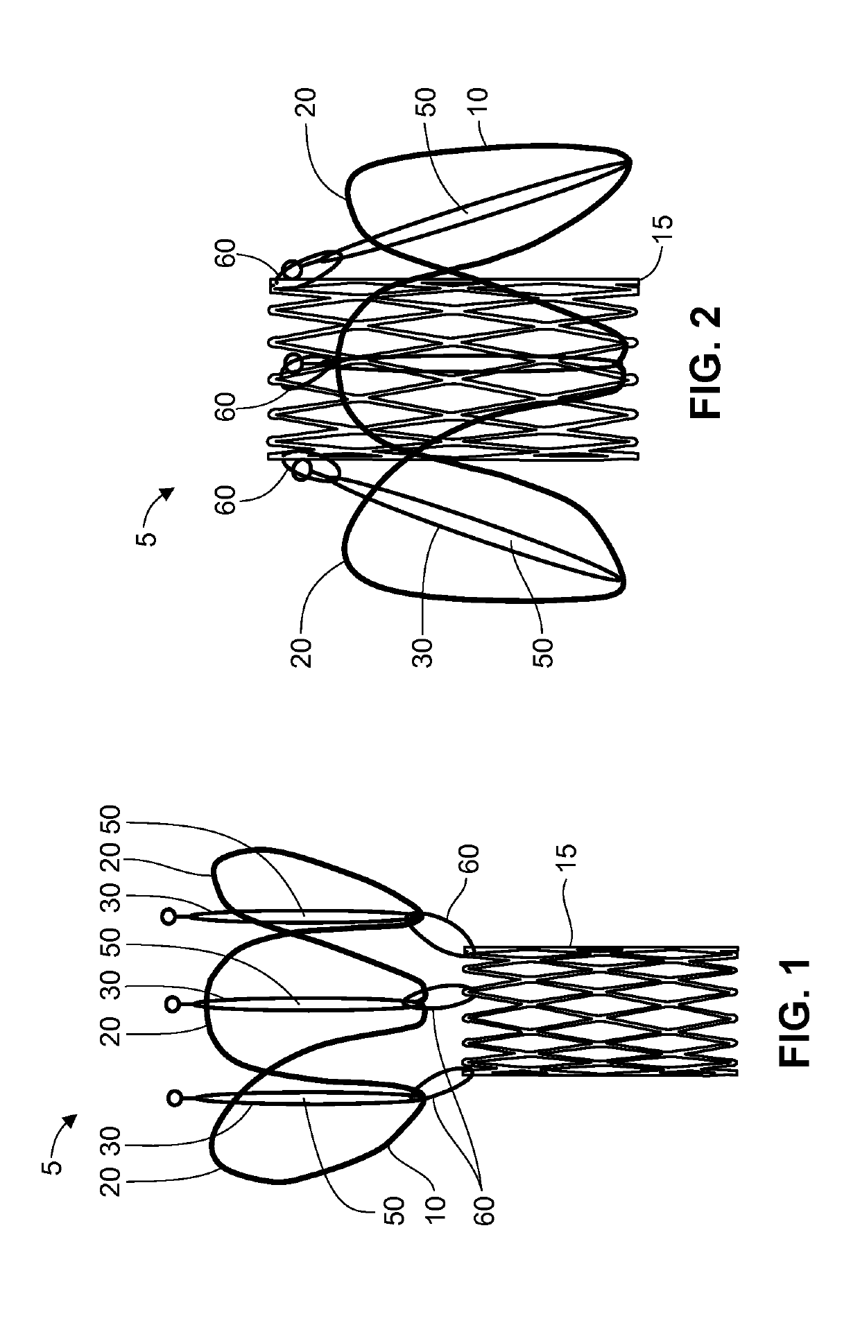 Sutureless valve prosthesis delivery device and methods of use thereof