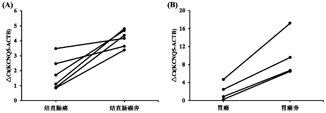 Primer probe group, kit, detection method and application for alimentary canal tumor marker detection