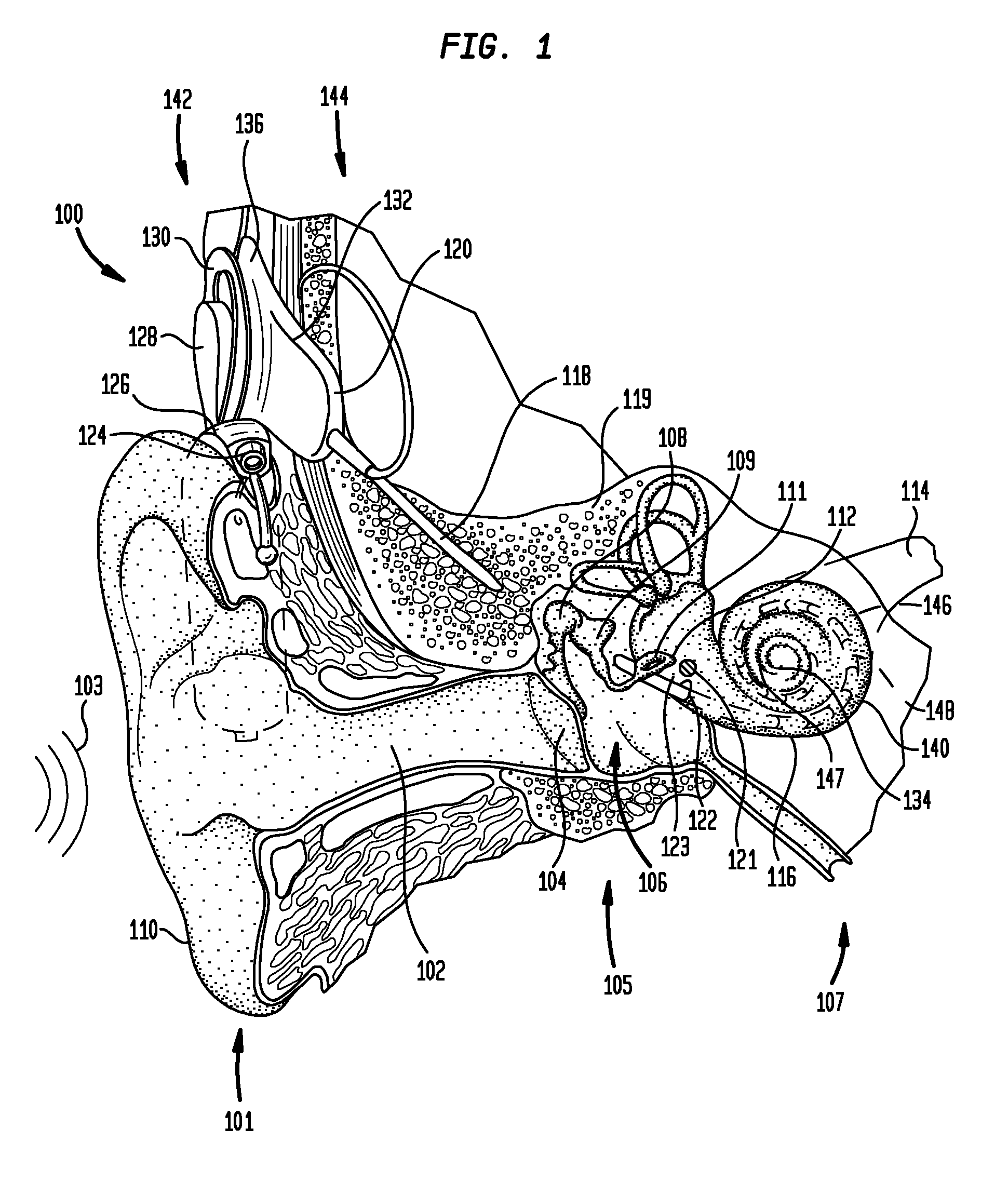 Securing an implanted medical device in a patient