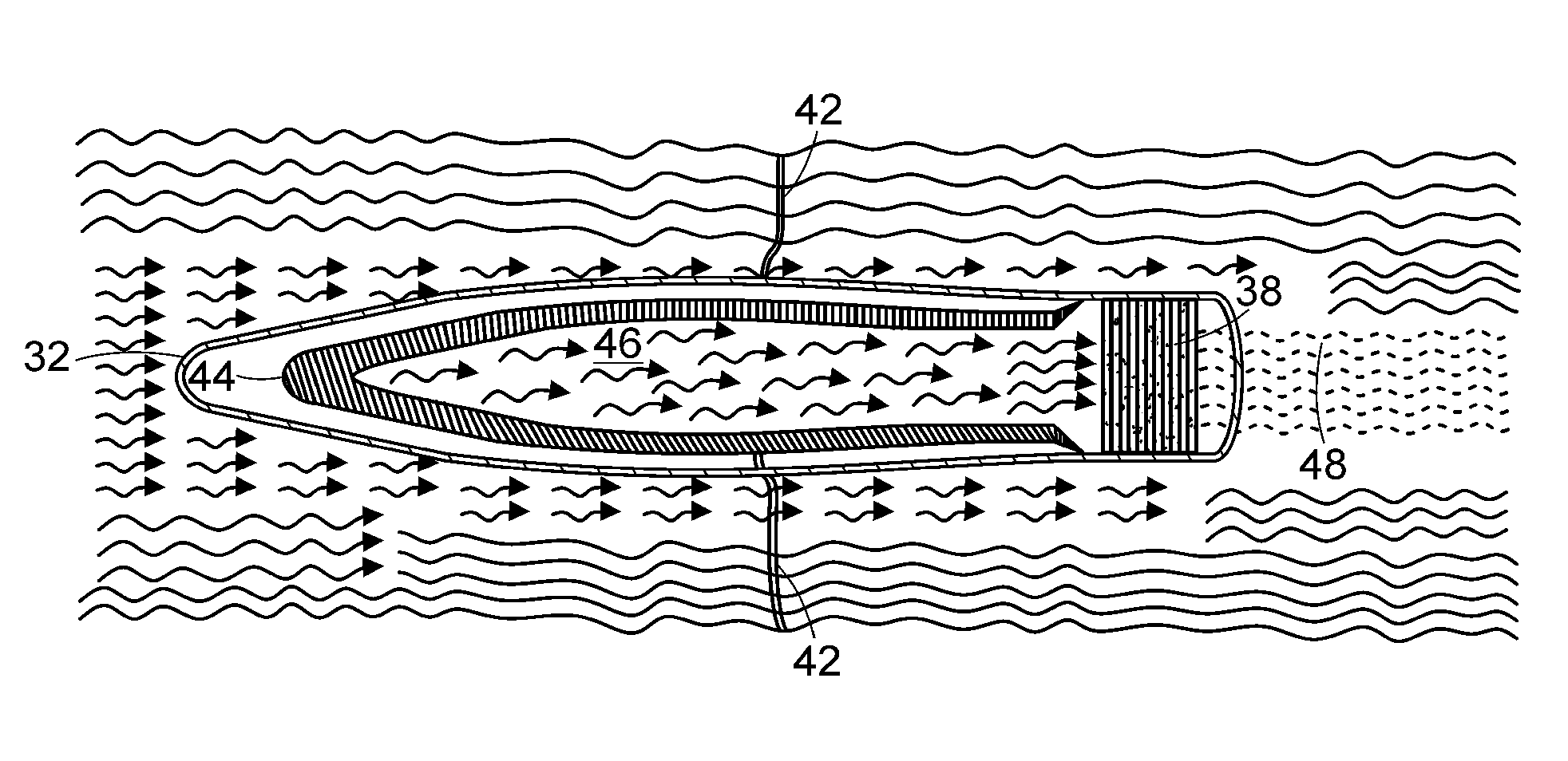 Extracorporeal cell-based therapeutic device and delivery system