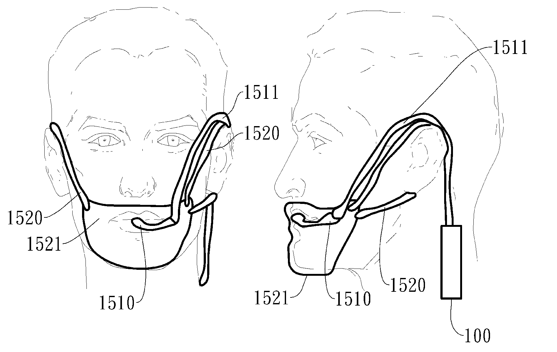 Negative pressure oral apparatus