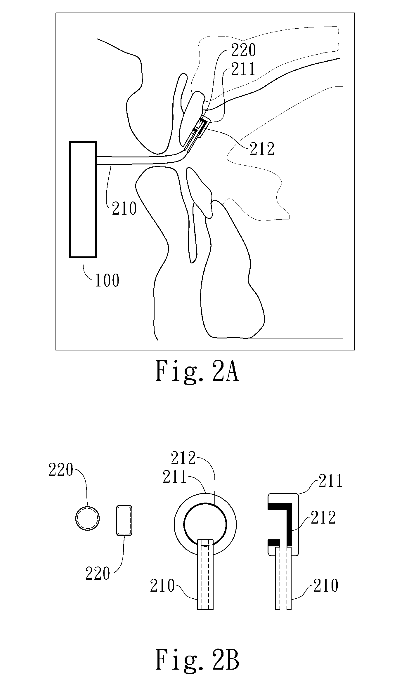 Negative pressure oral apparatus