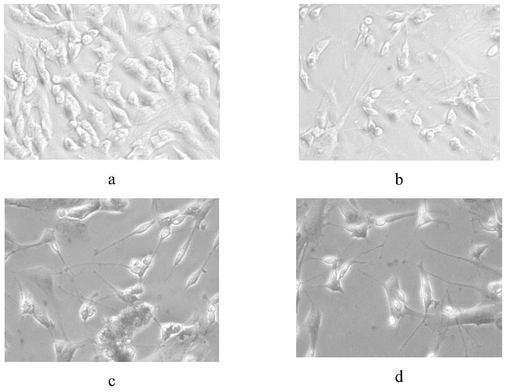 Preparation method and application of conditioned medium for deer periosteum