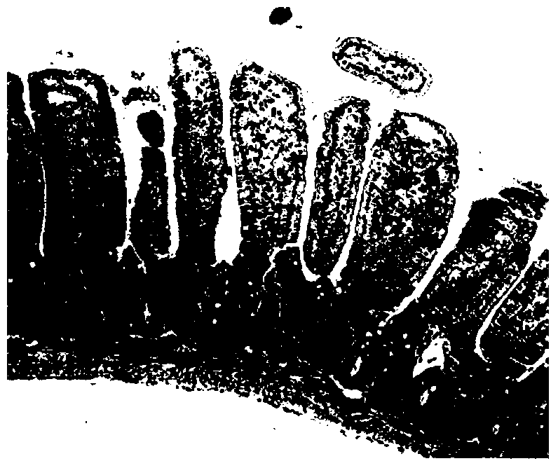 A kind of gastrointestinal contrast agent and preparation method thereof