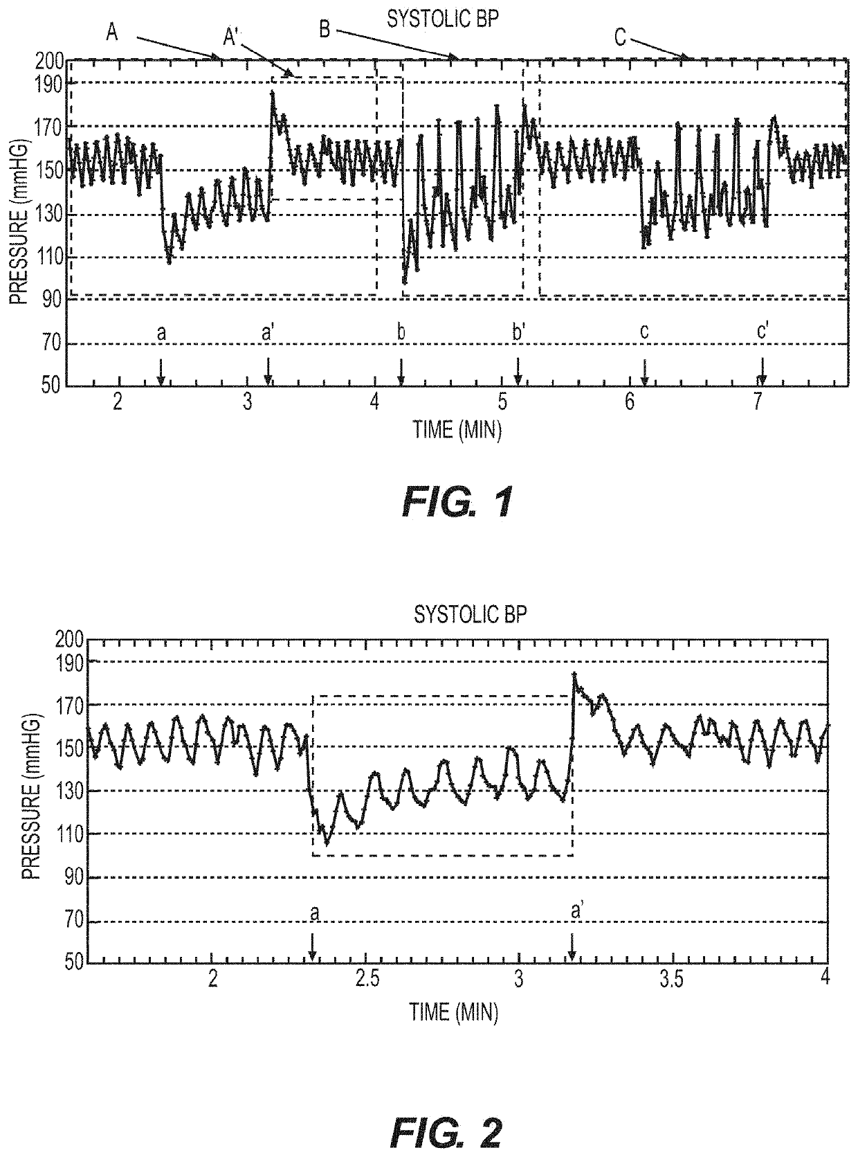 Methods and Systems for Controlling Blood Pressure