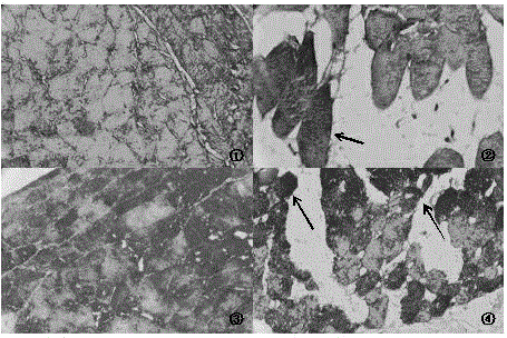 Method for establishing hypothyroidism Wistar rat orbit model by adopting radioactive internal radiation