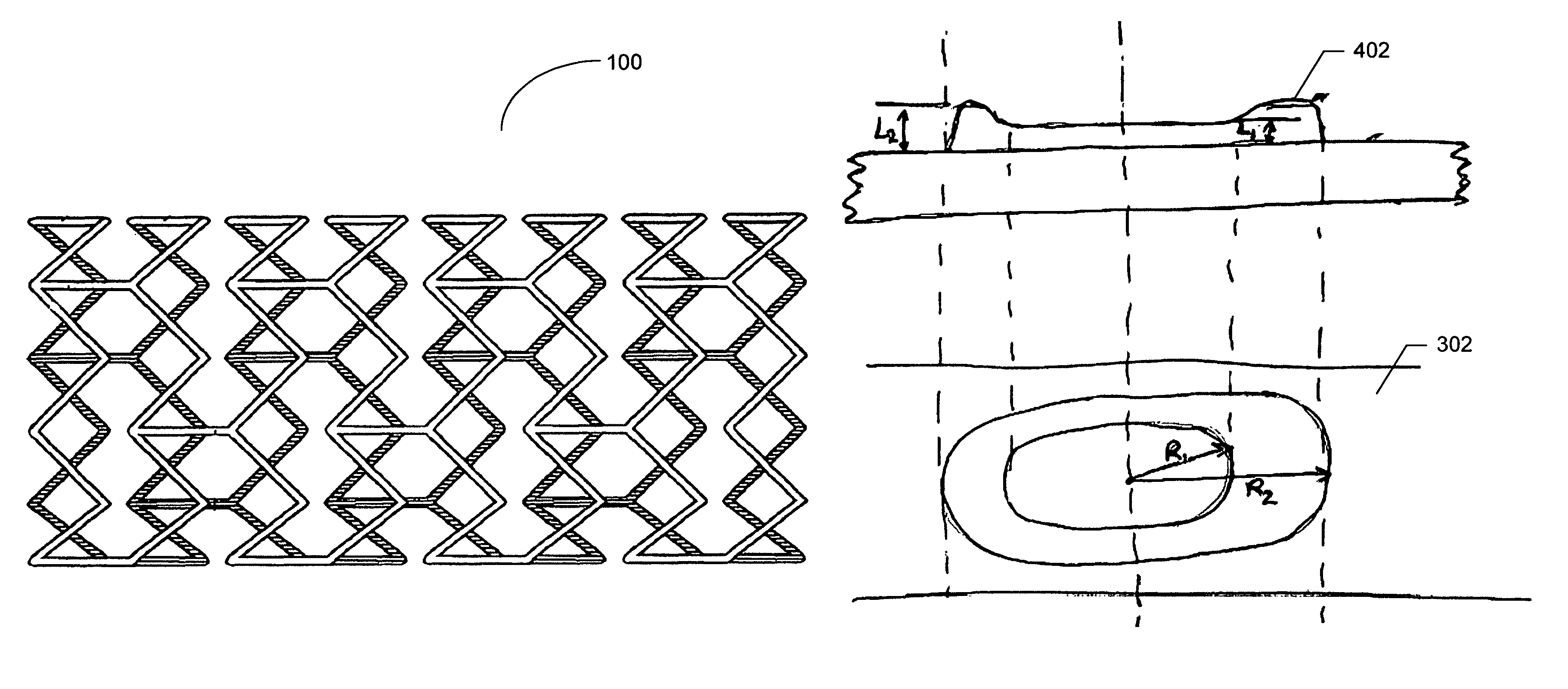 Device with engineered surface architecture coating for controlled drug release