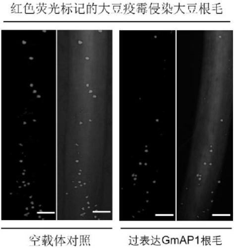 Gene GmAP1 capable of improving disease resistance of plants and application of gene GmAP1