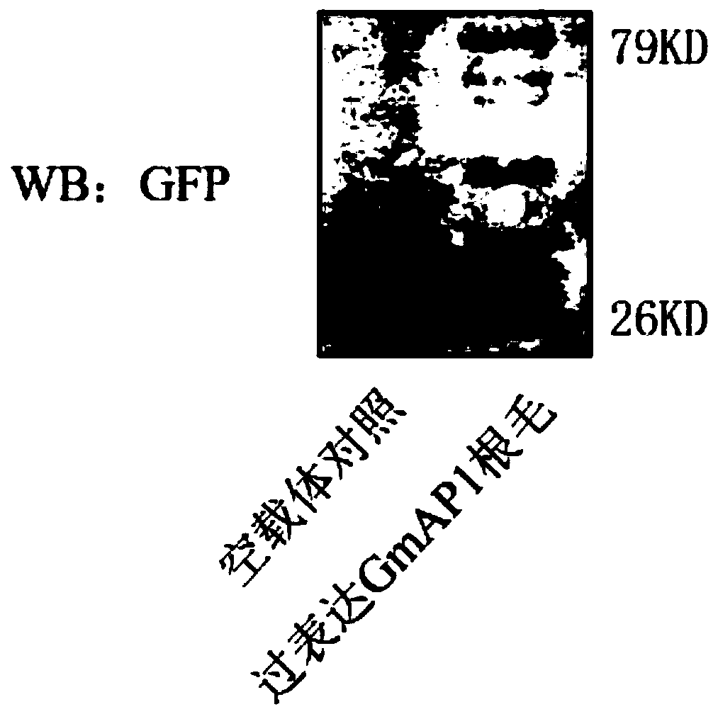 Gene GmAP1 capable of improving disease resistance of plants and application of gene GmAP1