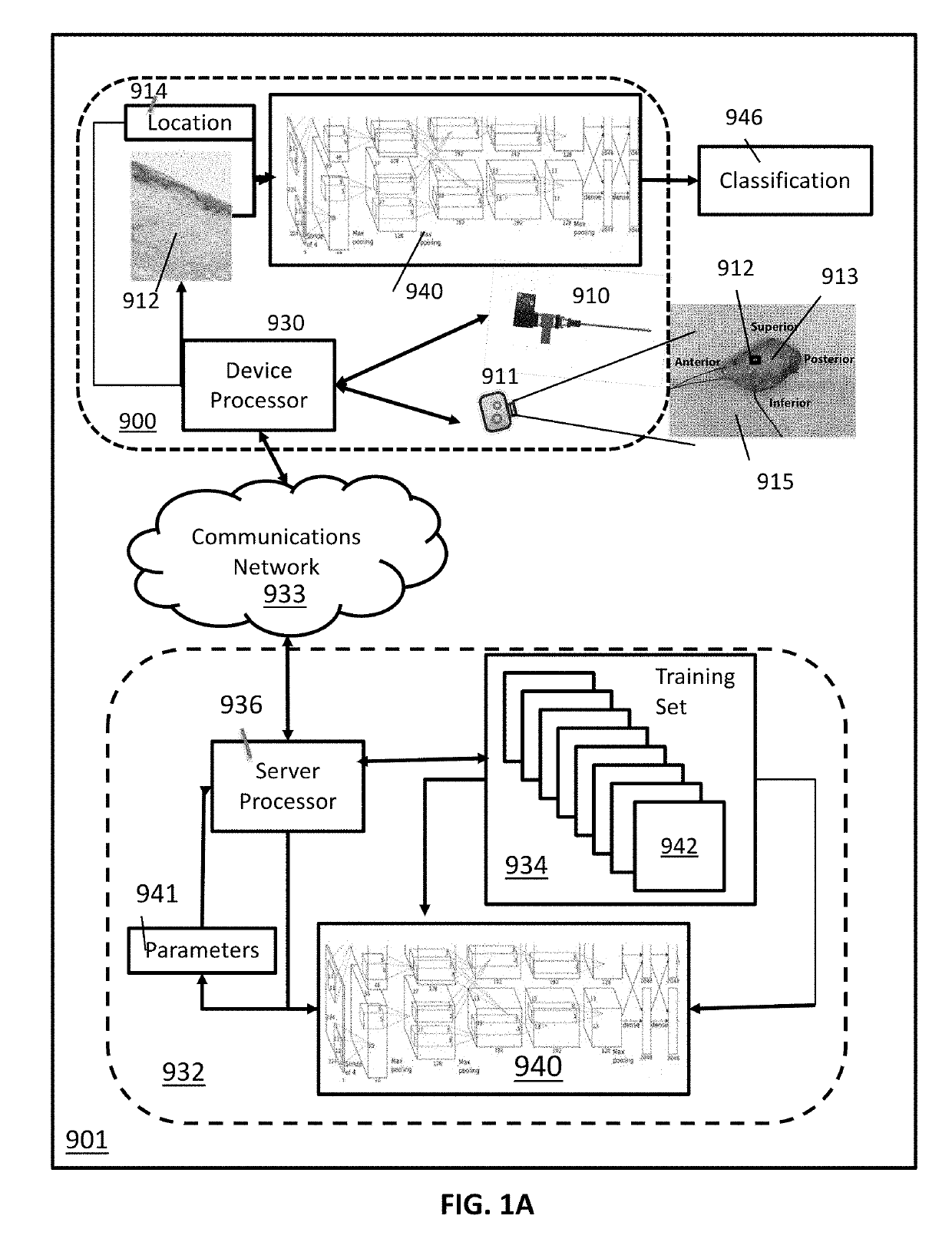 Optical coherence tomography for cancer screening and triage