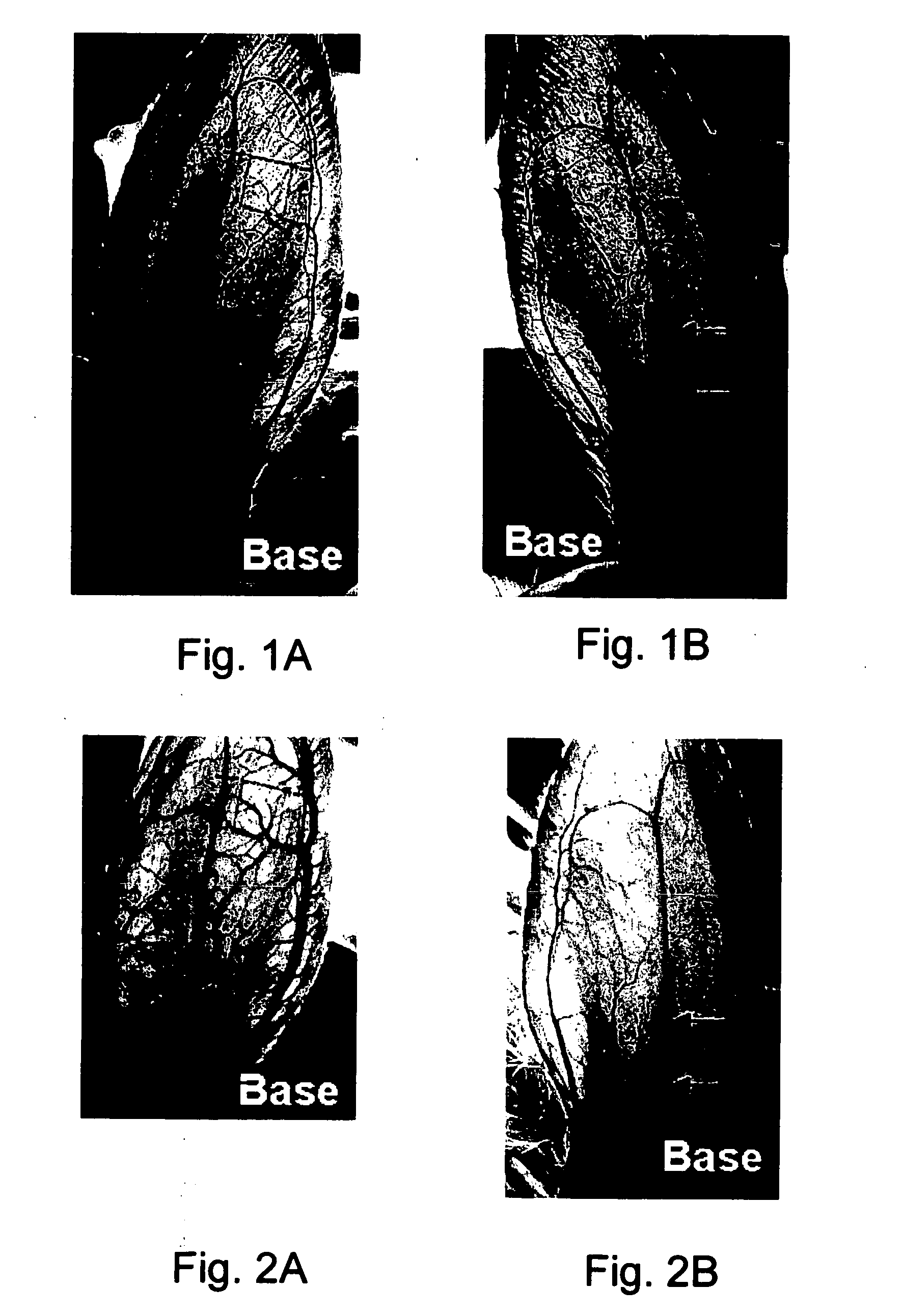 Prostaglandin compositions and methods for the treatment of vasospasm