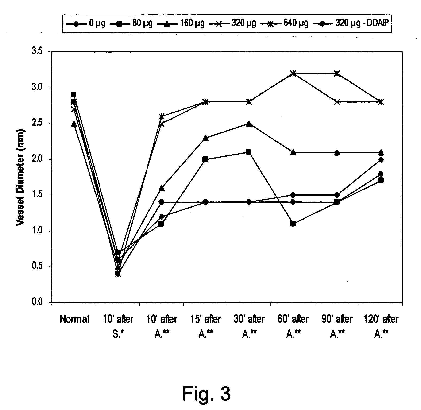 Prostaglandin compositions and methods for the treatment of vasospasm