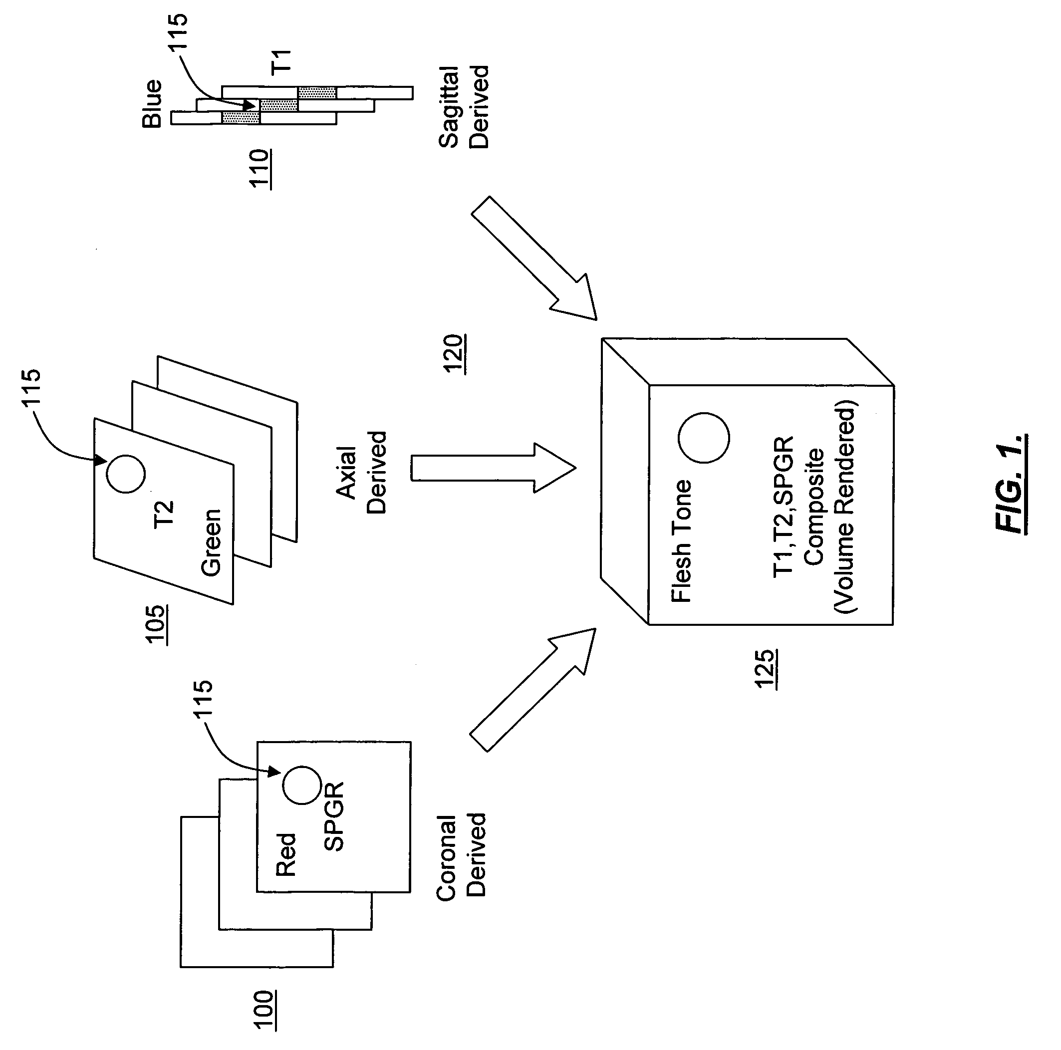 Opposed orthogonal fusion system and method for generating color segmented MRI voxel matrices